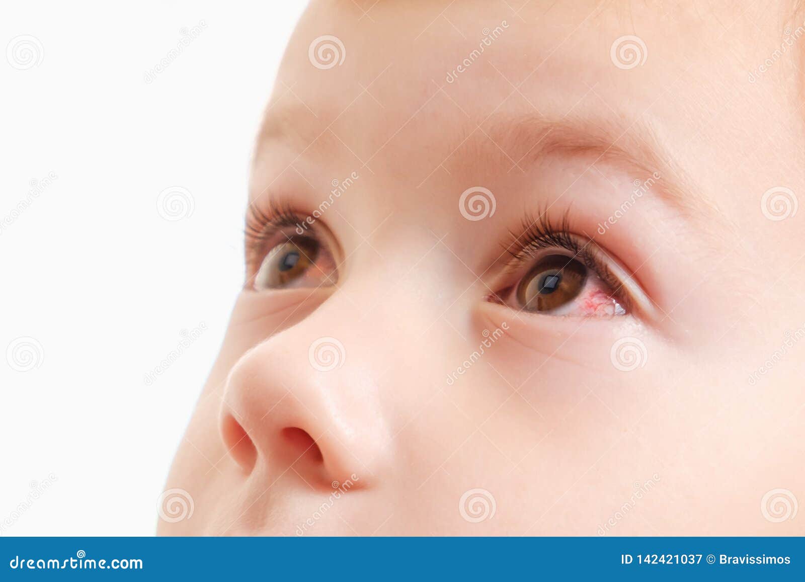 259 Child Eye Injury Photos Free Royalty Free Stock Photos From Dreamstime 259 Child Eye Injury Photos Free Royalty Free Stock Photos From Dreamstime