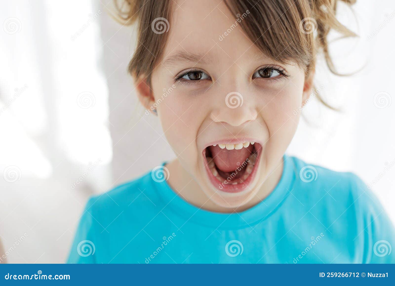 The Child Has Lost a Tooth. Little Girl without a Tooth. the First