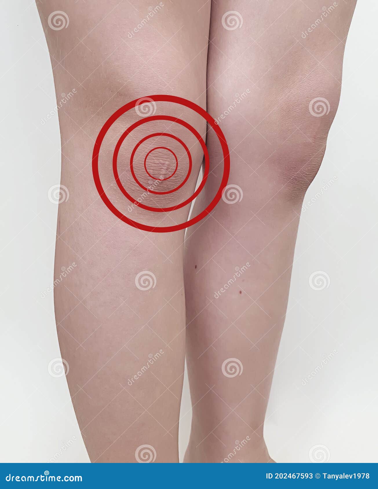 Child Hurts Knee on Light Background Accident Kid Stock Image Image