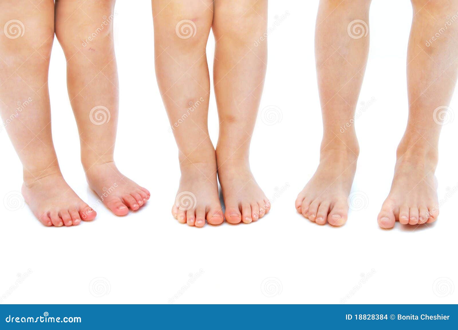 Childhood Bumps and Bruises Stock Photo Image of girls, hurt 18828384