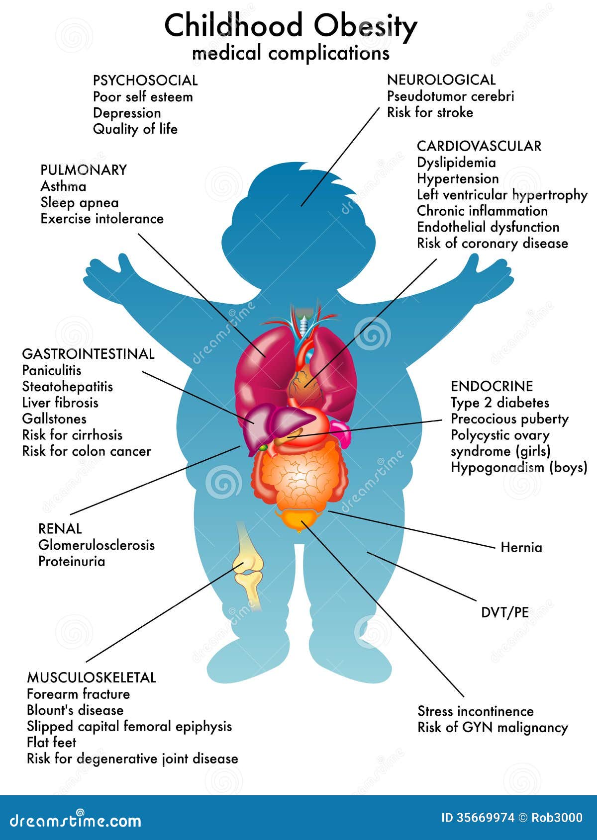 Childhood Obesity Effects