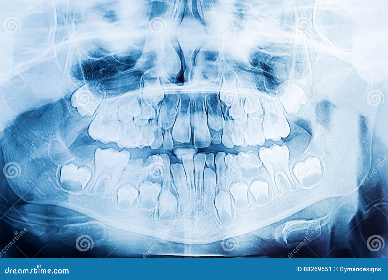 Children dental xray stock image. Image of mandible 88269551