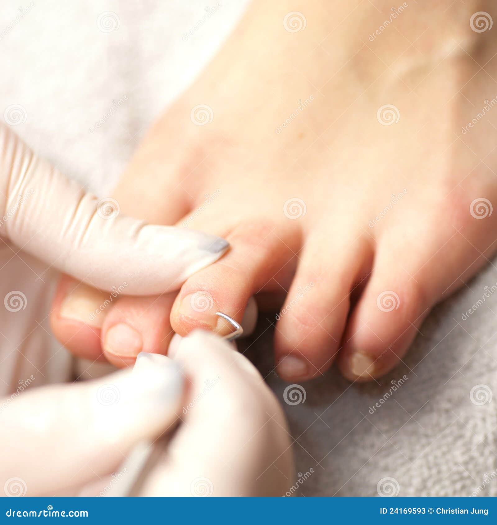 chiropody