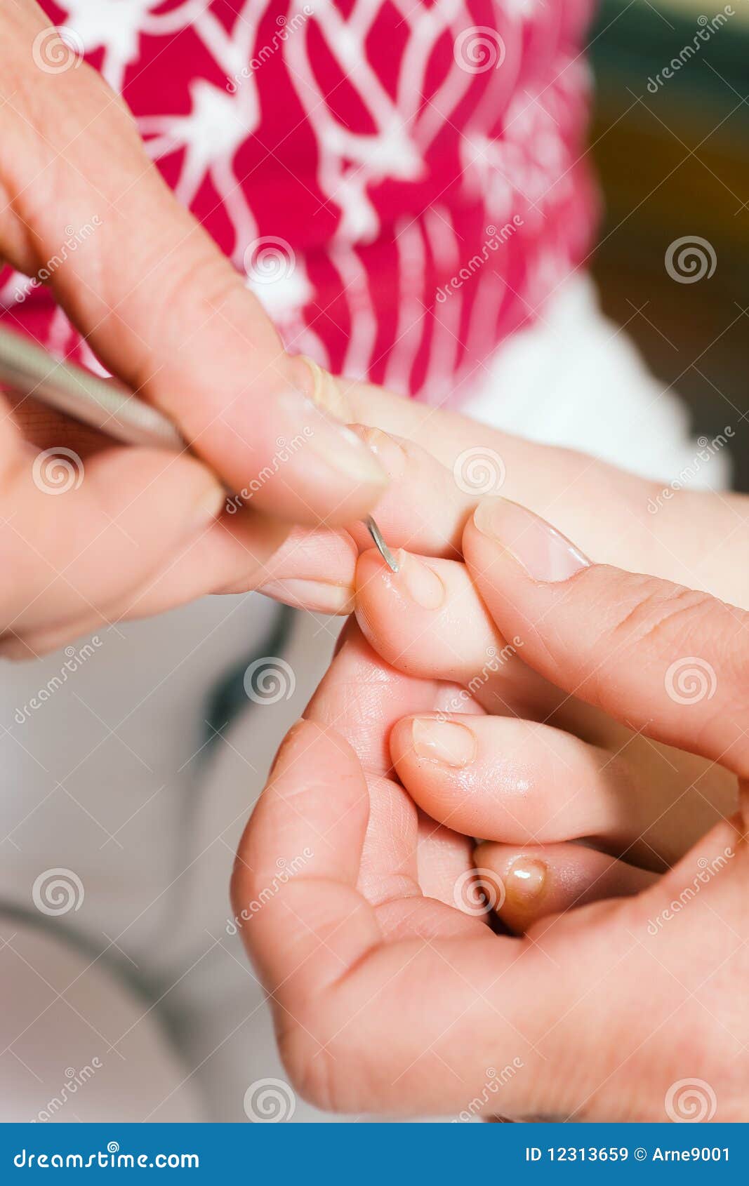 Chiropody foot care stock image. Image of podiatry 12313659