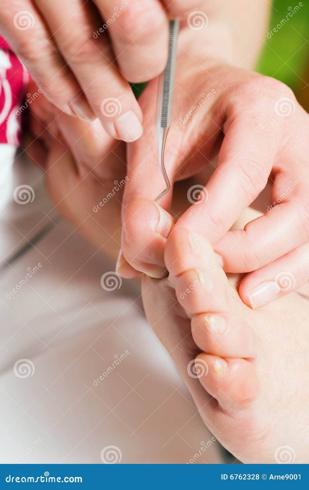Chiropody foot care stock photo. Image of tool, podiatry 6762328