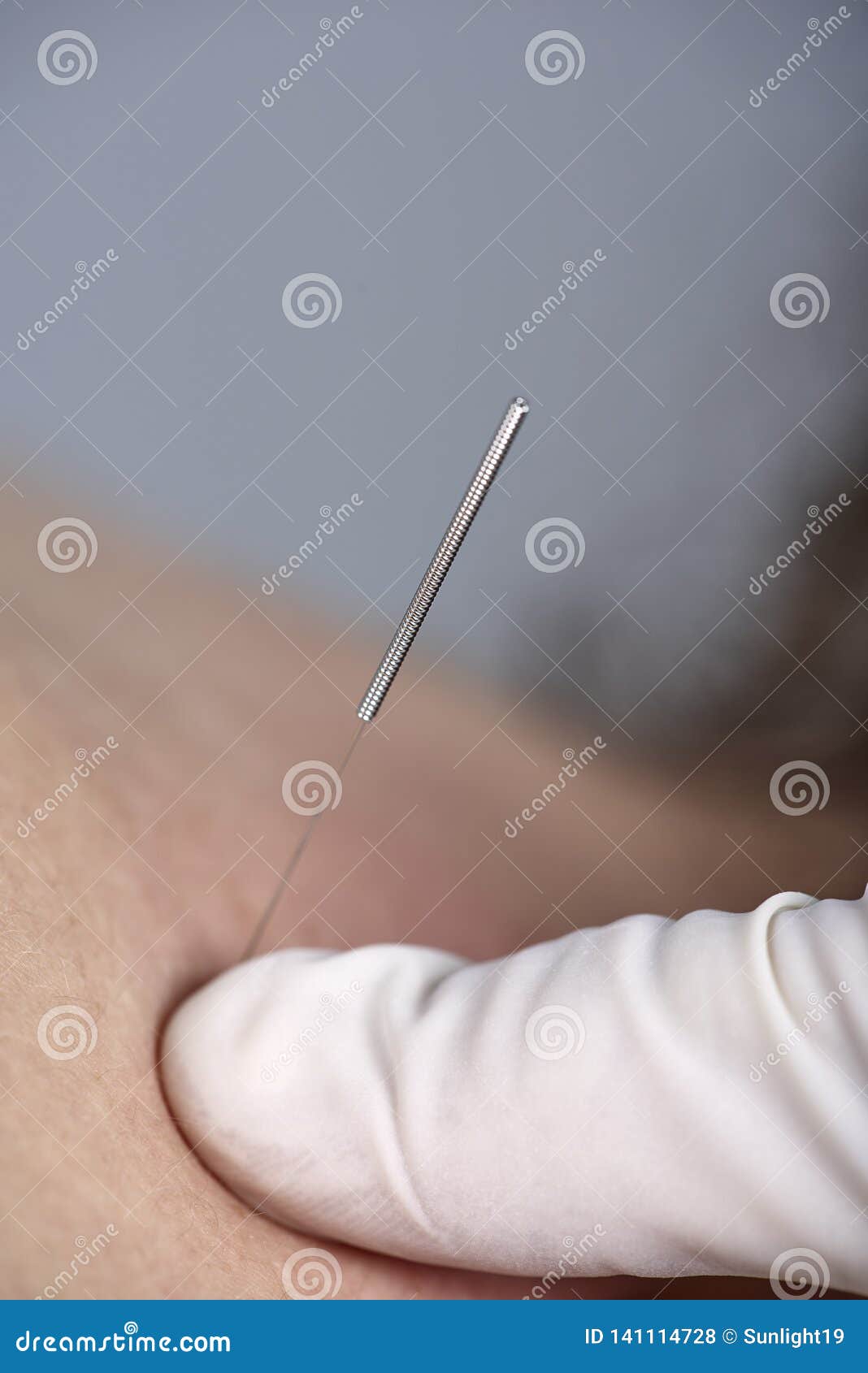 Download Aculife Hand Acupuncture Manual Download Aculife Hand Acupuncture Manual