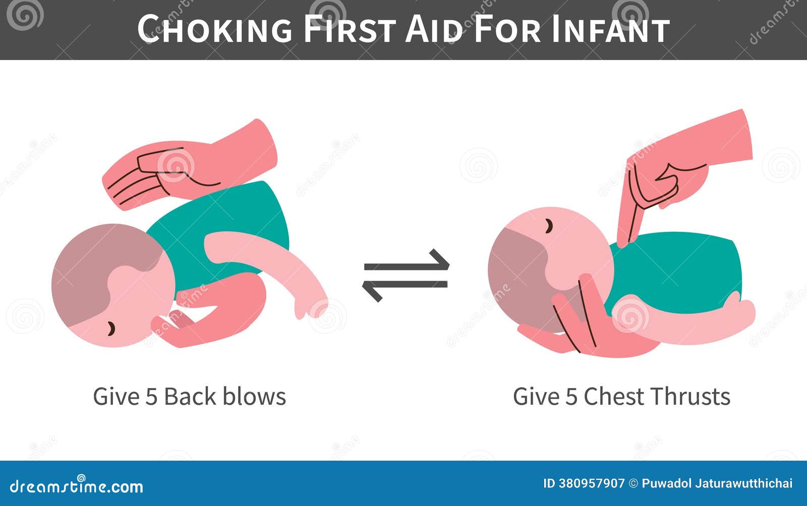 Choking First Aid for Infant Cartoon Illustration . Back Blows and ...