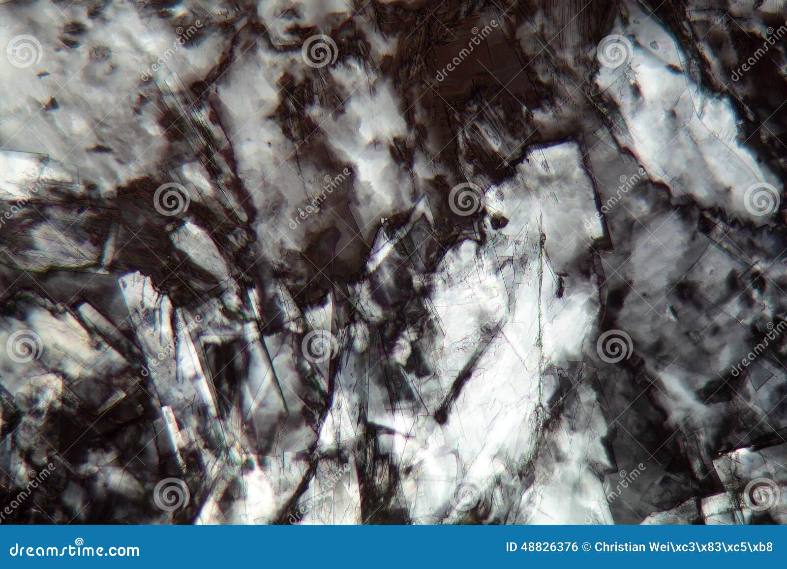 Cholesterol Crystals Under a Microscope Stock Photo Image of artery