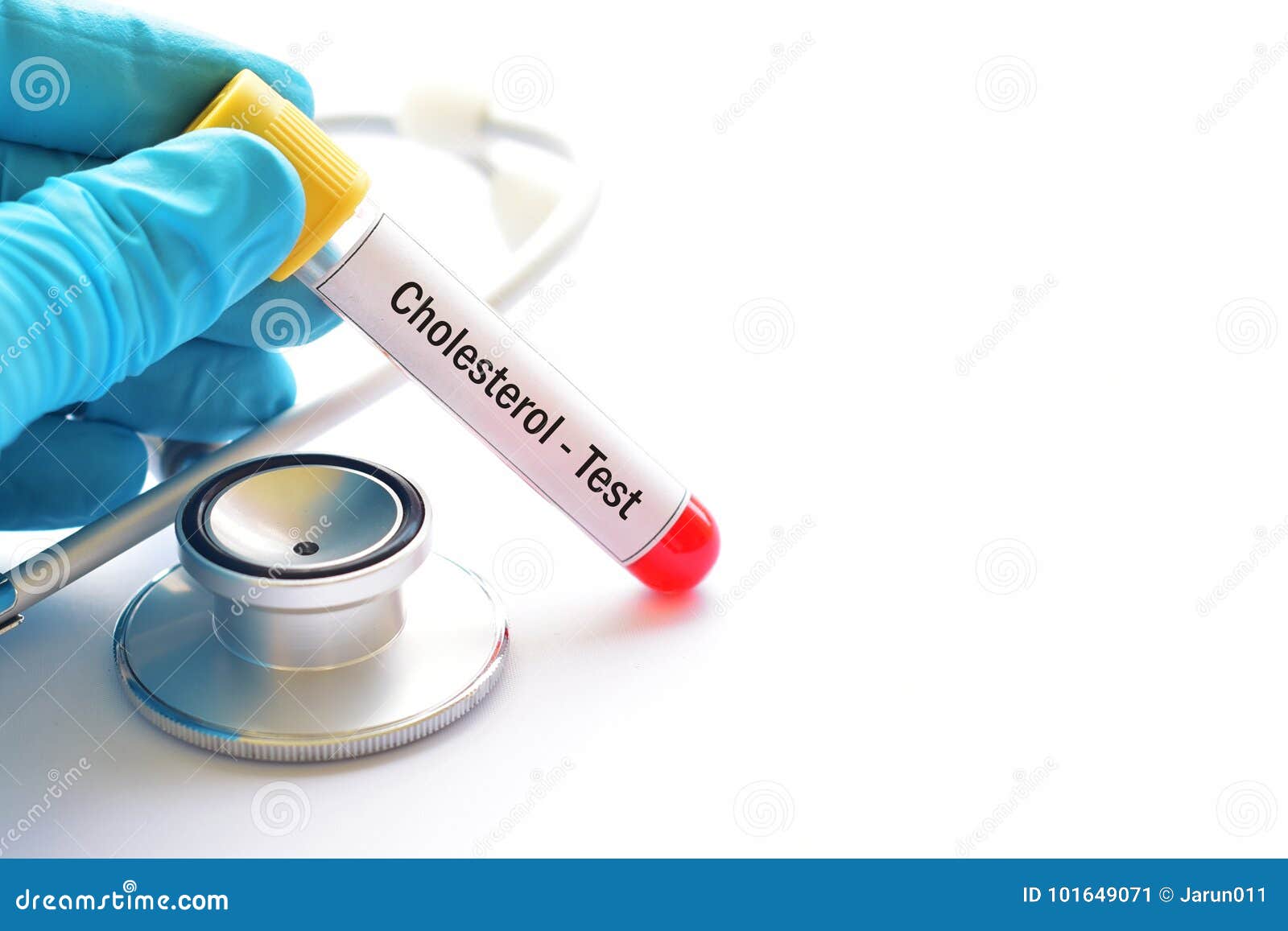 Cholesterol test stock image. Image of disease, clot 101649071