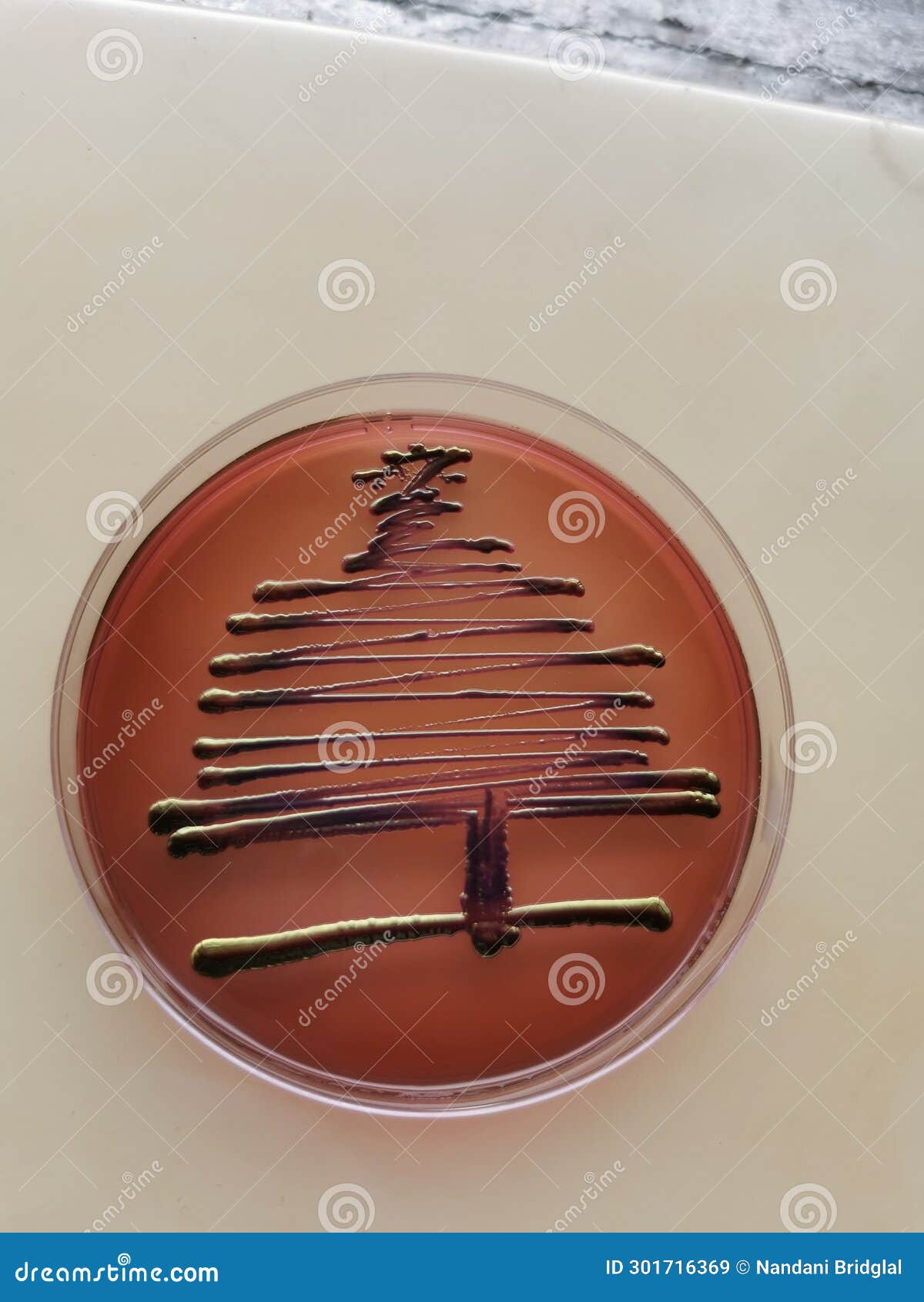 Christmas Tree Pattern of Escherichia Coli Stock Image - Image of escherichia, decorations ...