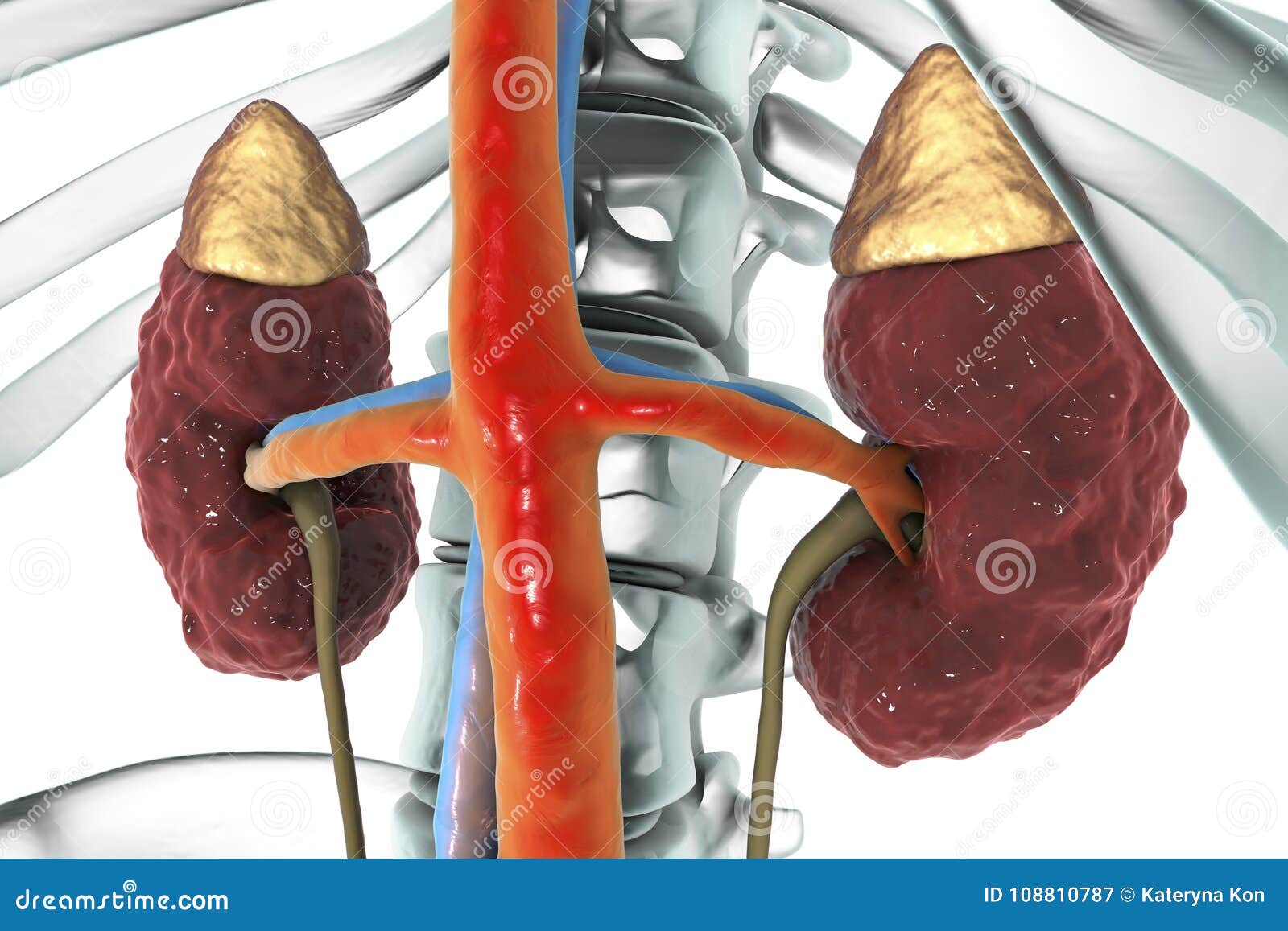 adrenal kidney failure