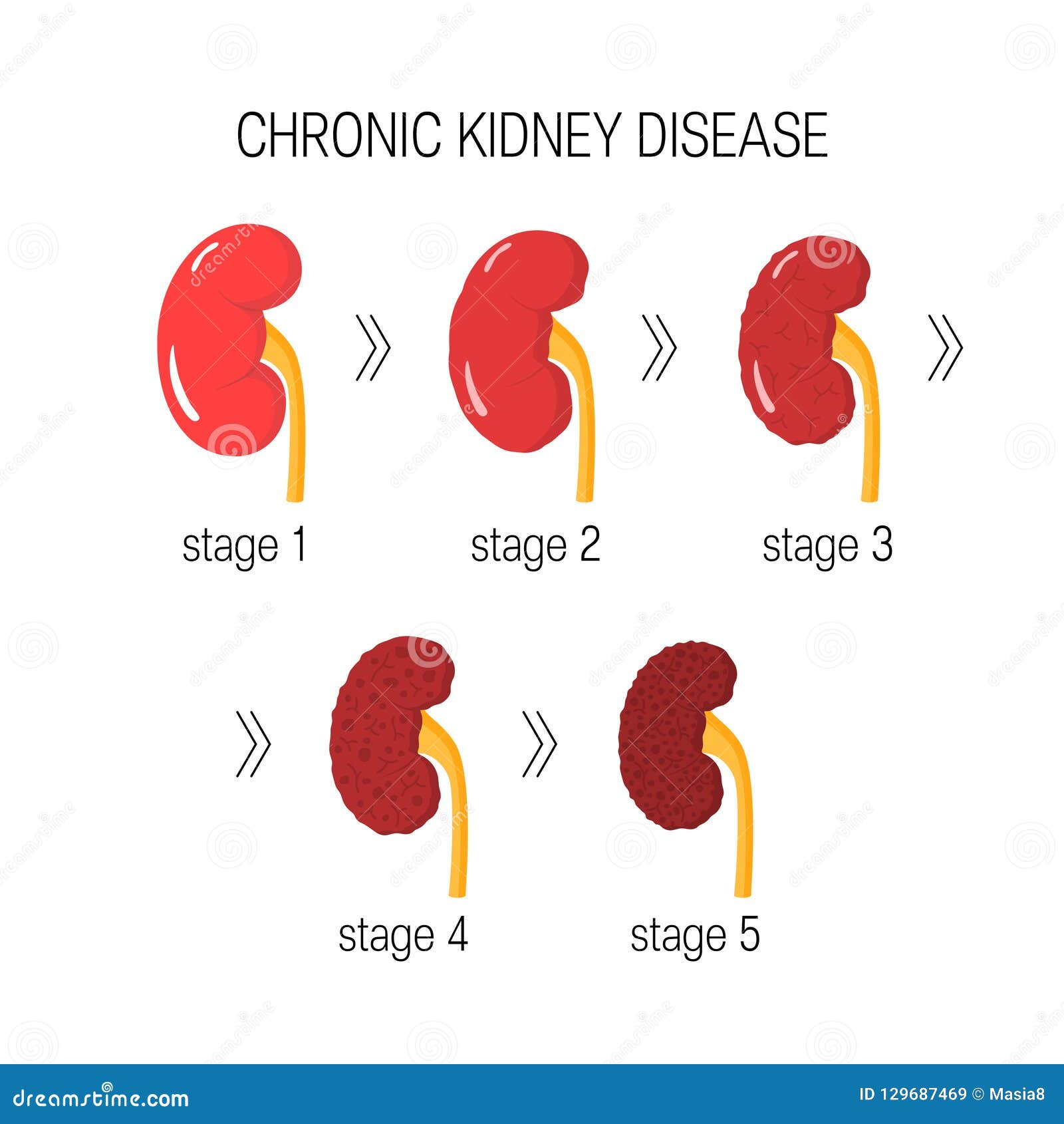 chronic kidney disease 