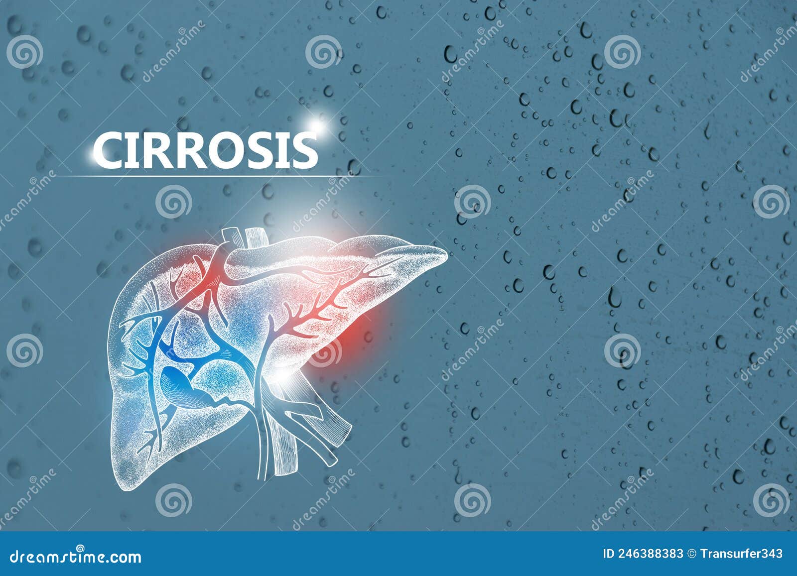 cirrosis - diagnÃÂ³stico y tratamiento, lista de comprobaciÃÂ³n mÃÂ©dica. fondo texturizado y espacio de copia vacÃÂ­o para texto