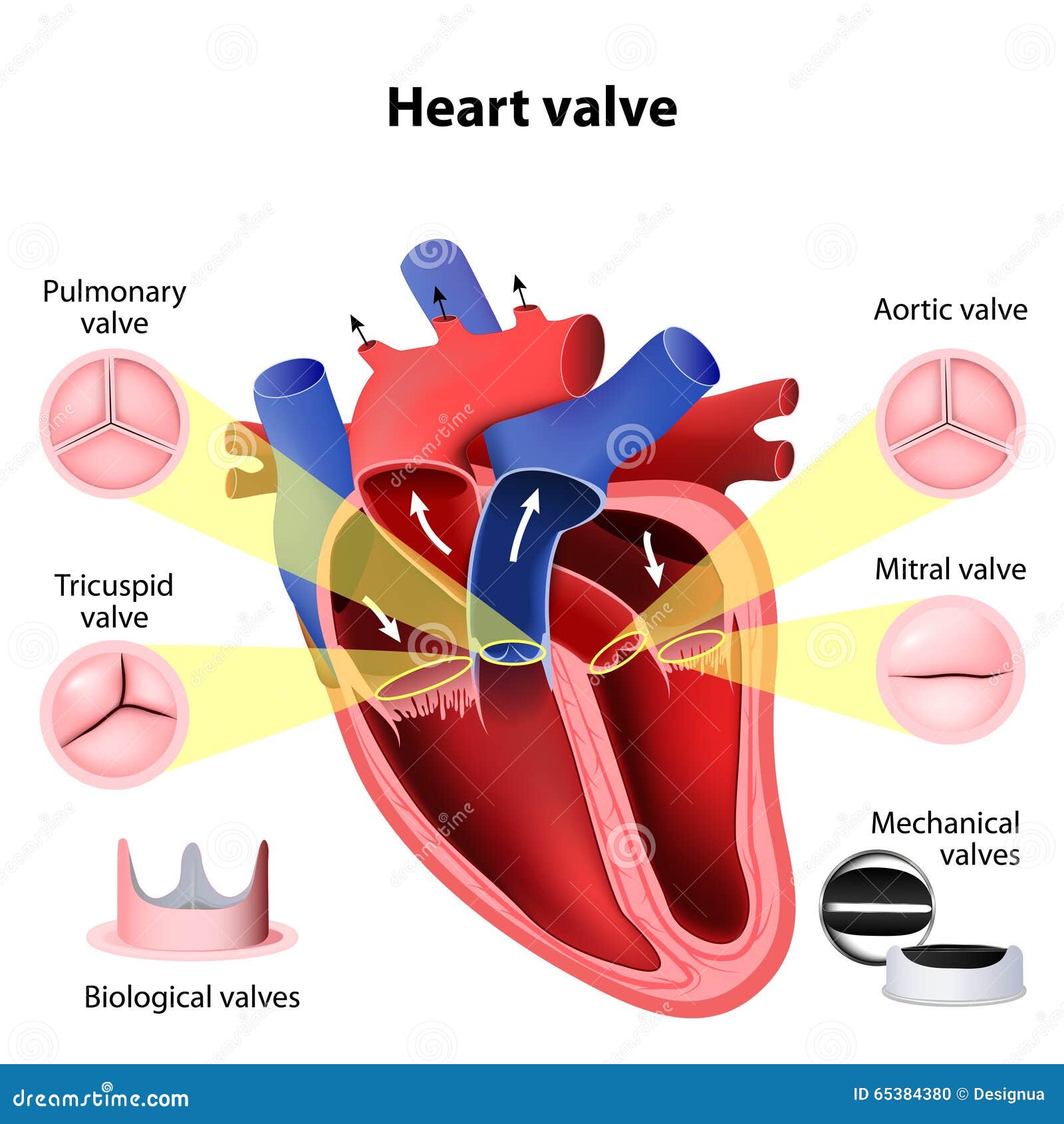Cirugía De La Válvula De Corazón Ilustración del Vector - Ilustración ...