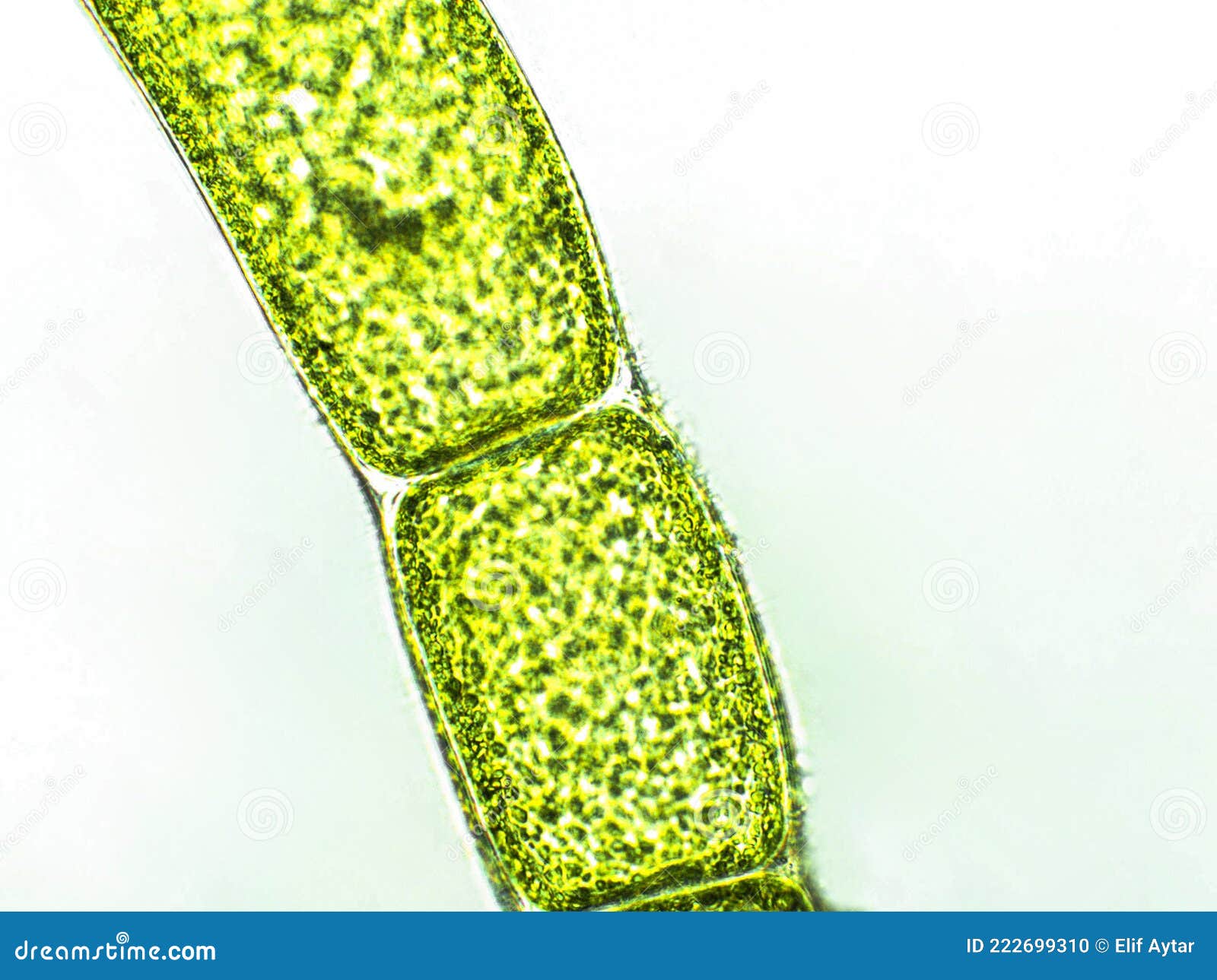 Cladophora Sp. Algae Under Microscopic View, Green Algae Stock Photo -  Image of close, life: 222699310