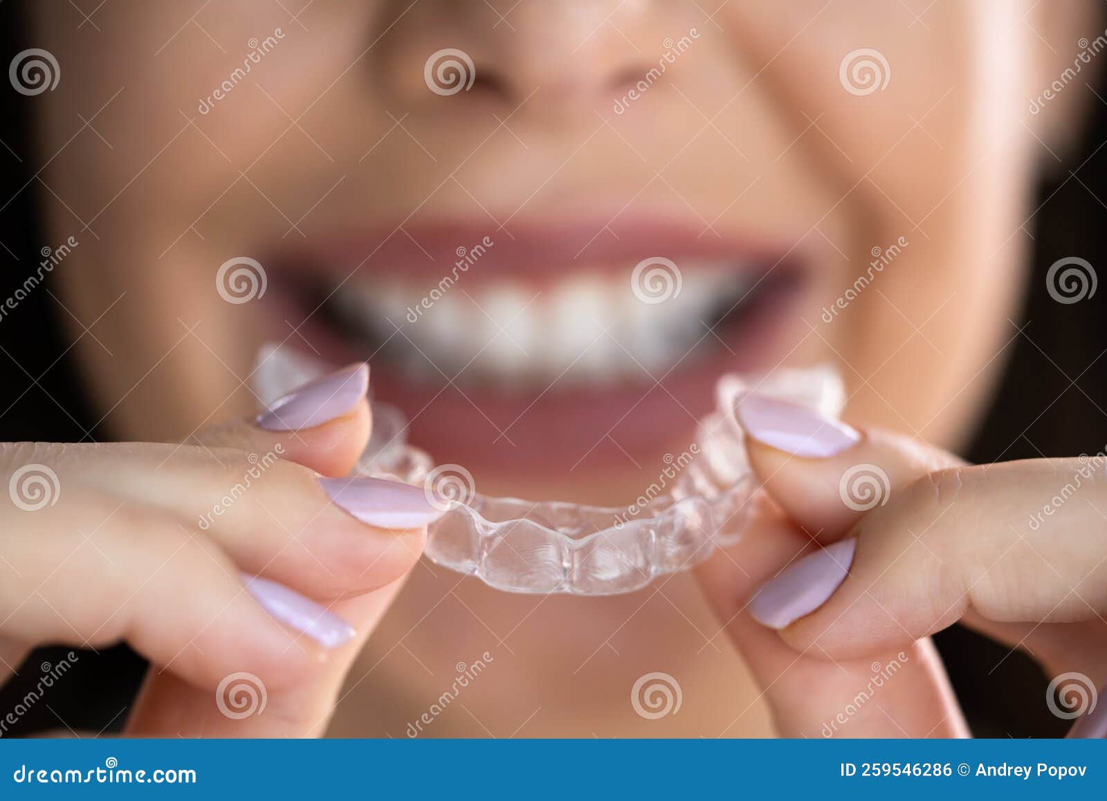 Clear Aligner Dental Night Guard Stock Photo Image of treatment