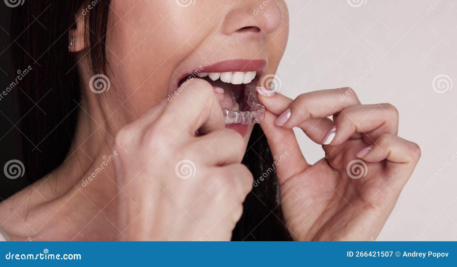 Clear Aligner Dental Night Guard Stock Image Image of mouth