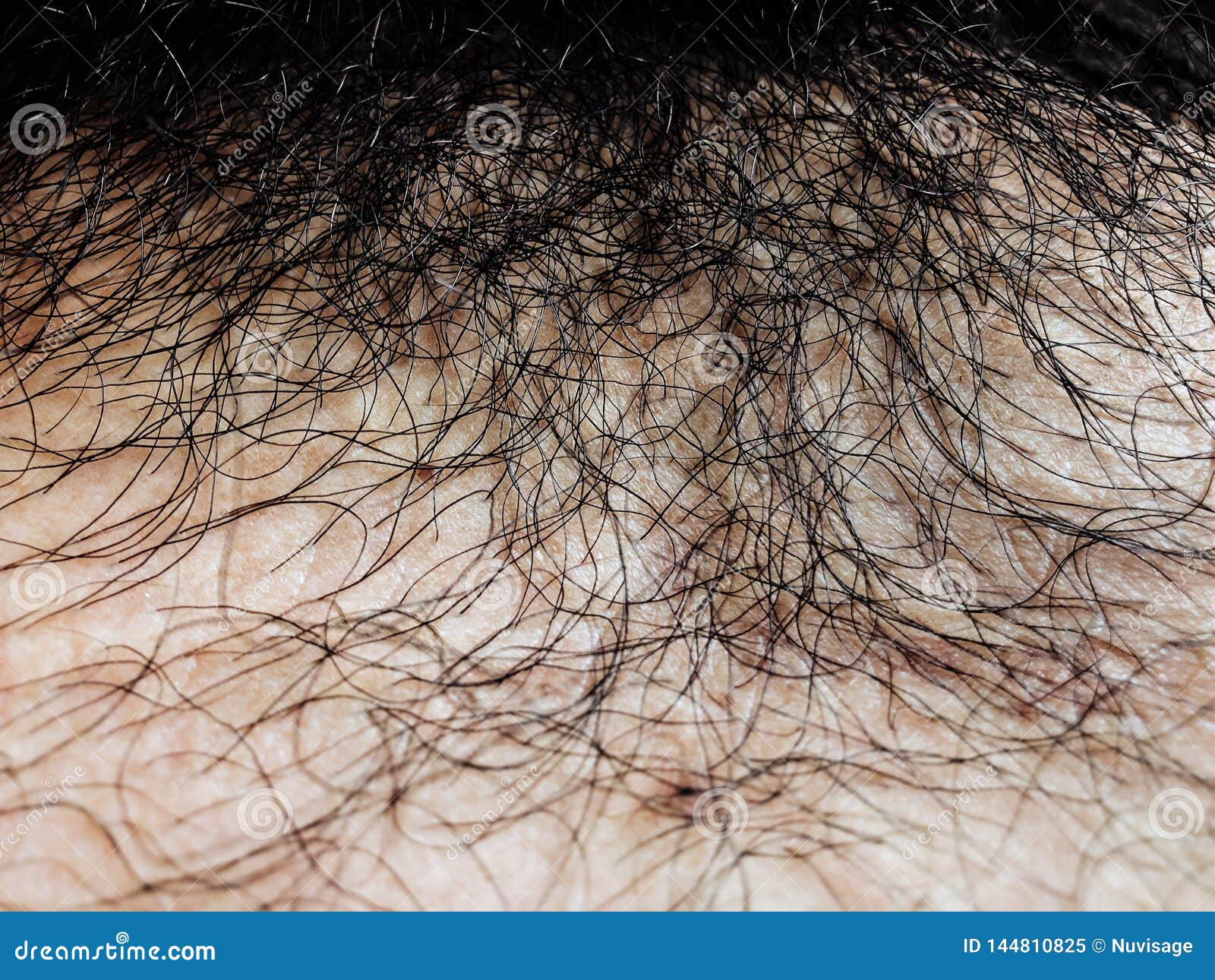 Close Up Asian Pubic Hair Yellow Skin Tone Stock Image - Image of curly,  crotch: 144810825