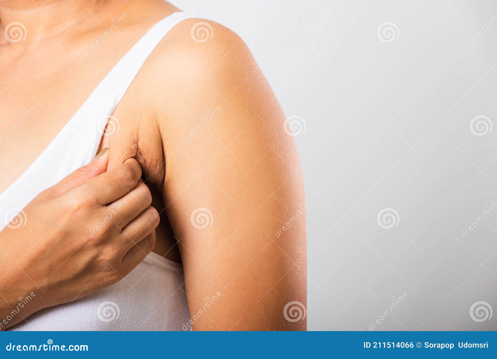 Woman Pulling Her Skin Underarm she Problem Armpit Fat Underarm Wrinkled  Skin Stock Photo - Image of girl, background: 211514066