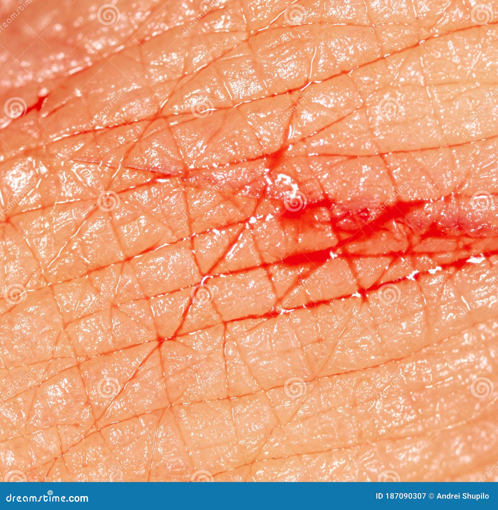 Close Up Of Blood From A Wound On A Human Skin Stock Image Image Of