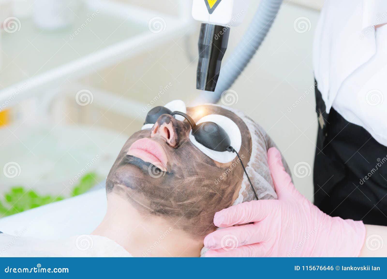 Close Up Carbon Face Peeling Procedure Laser Pulses Clean Skin Of The