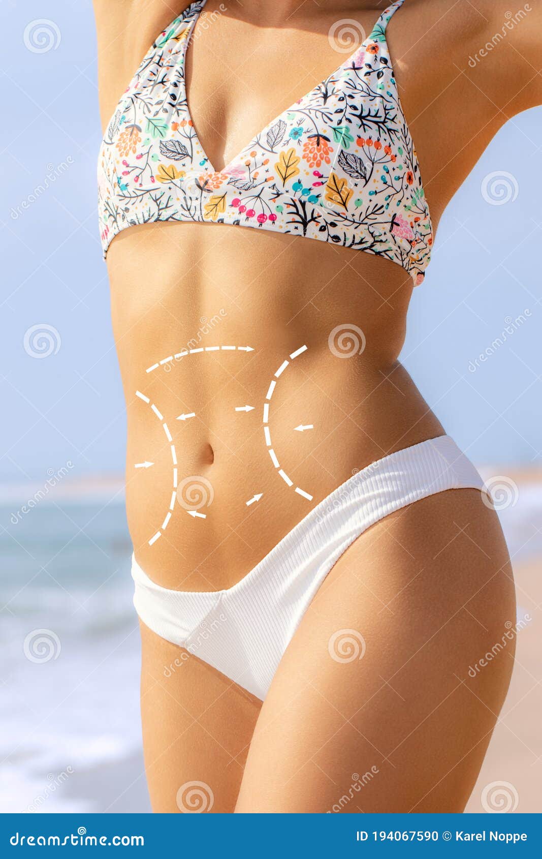 conceptual tummy tuck incision contour lines on female torso