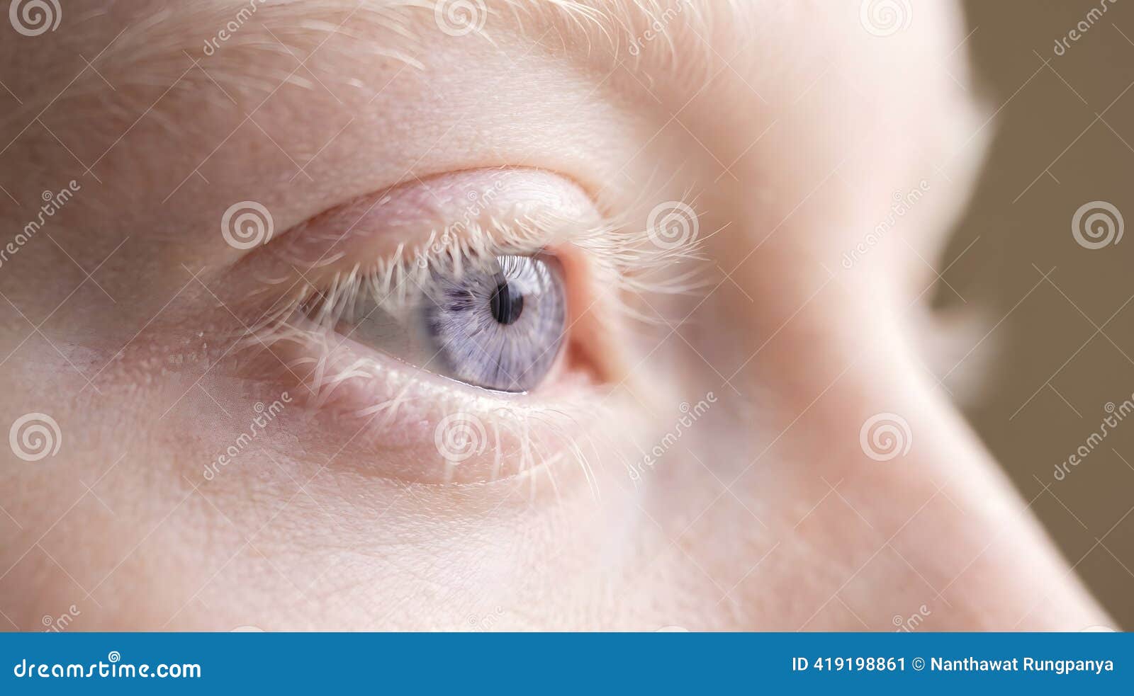 Albinismo Ilustrações, Vetores E Clipart De Stock – (699 Stock  Illustrations), image size:1600x983