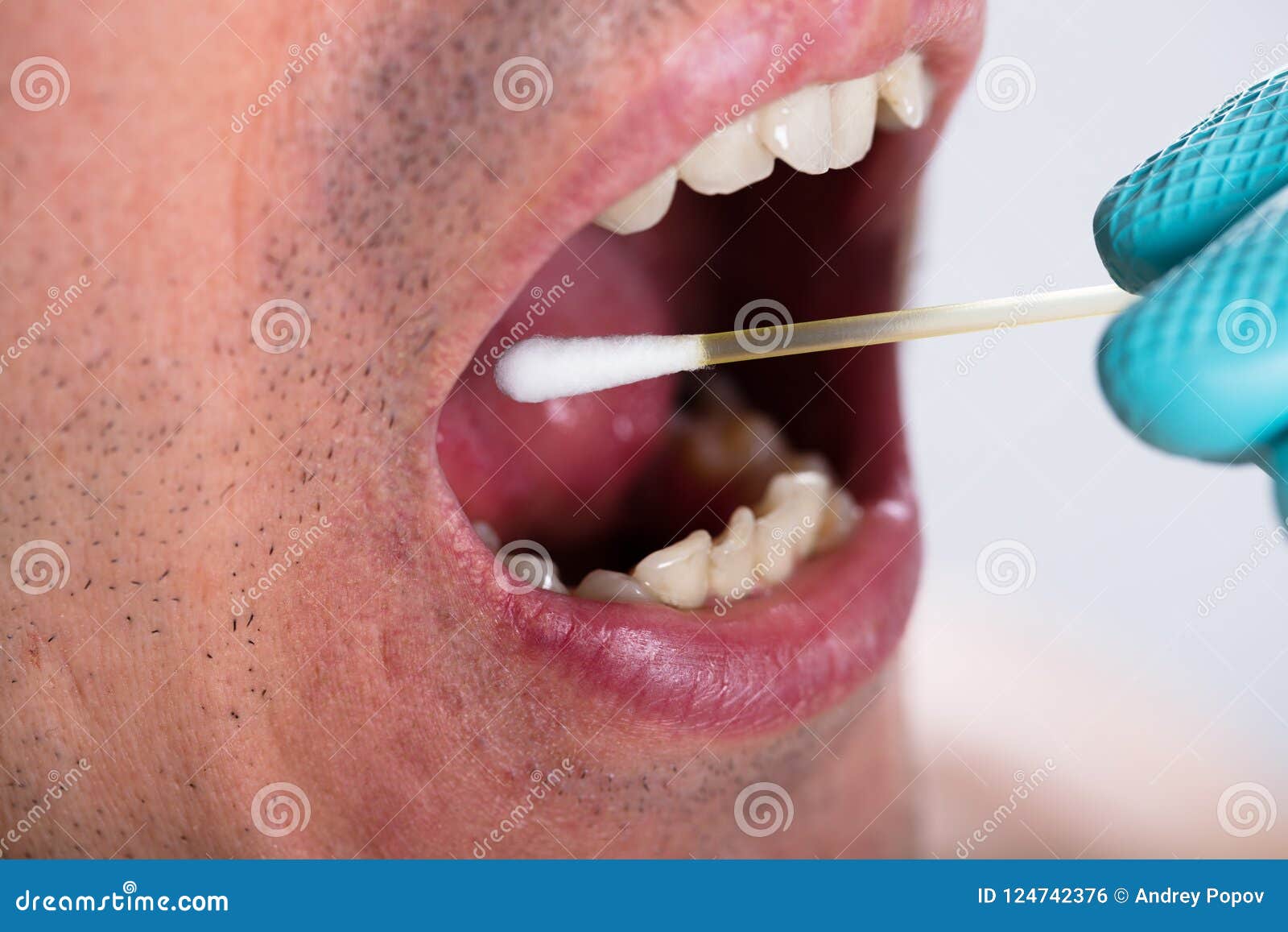 dentist making saliva test on the mouth with cotton swab