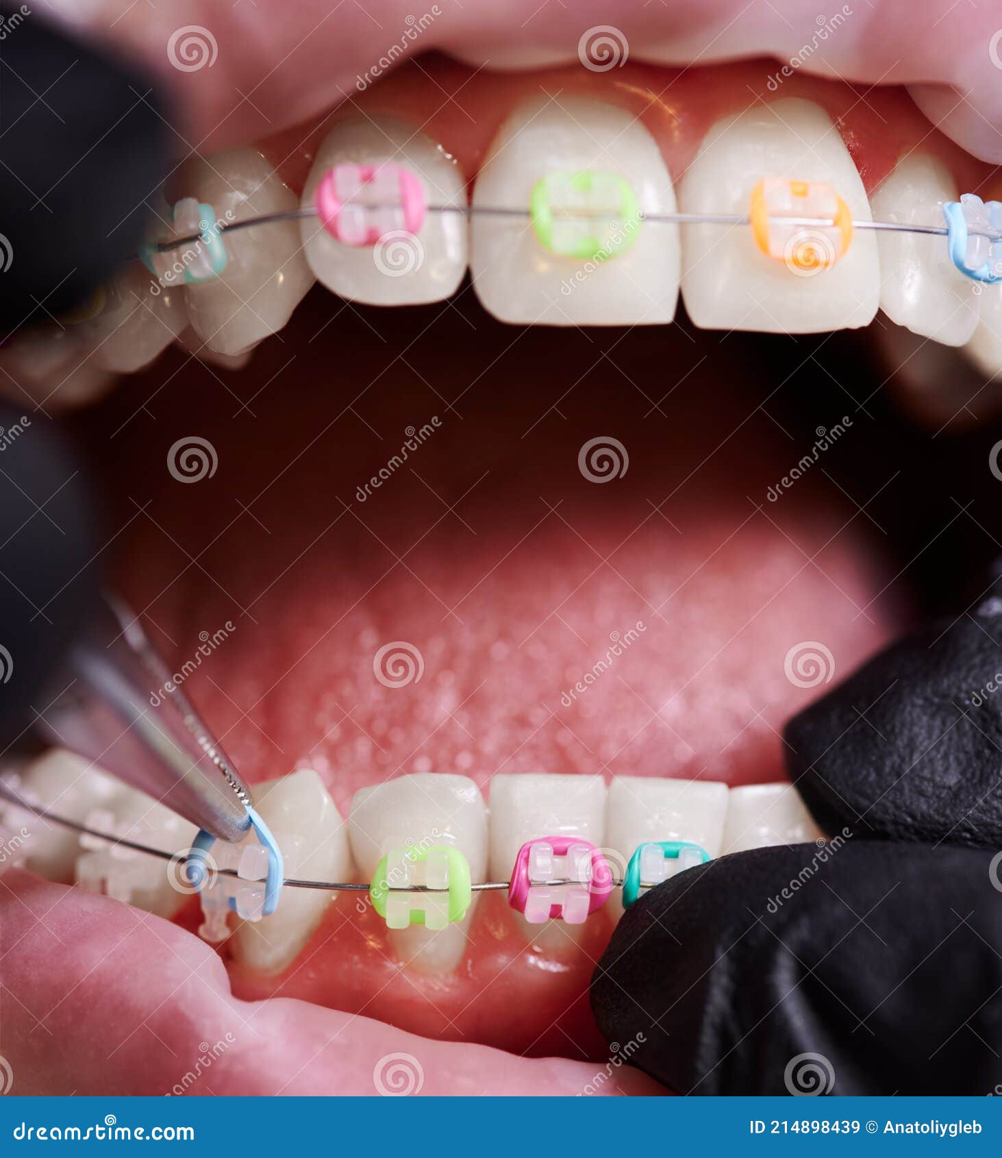 My Image 28
