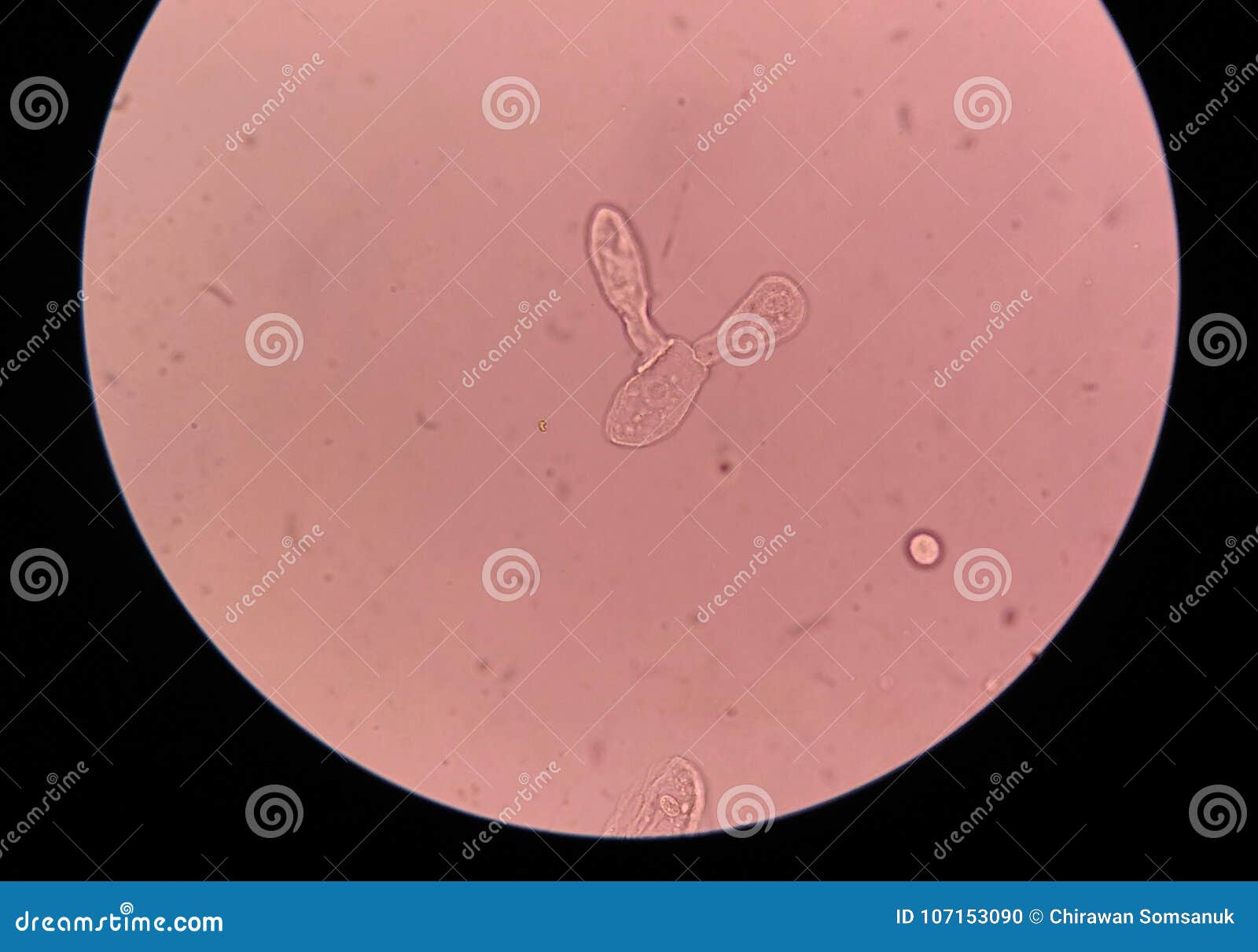 epithelial-cells-with-bacteria-stock-photo-cartoondealer-196729734