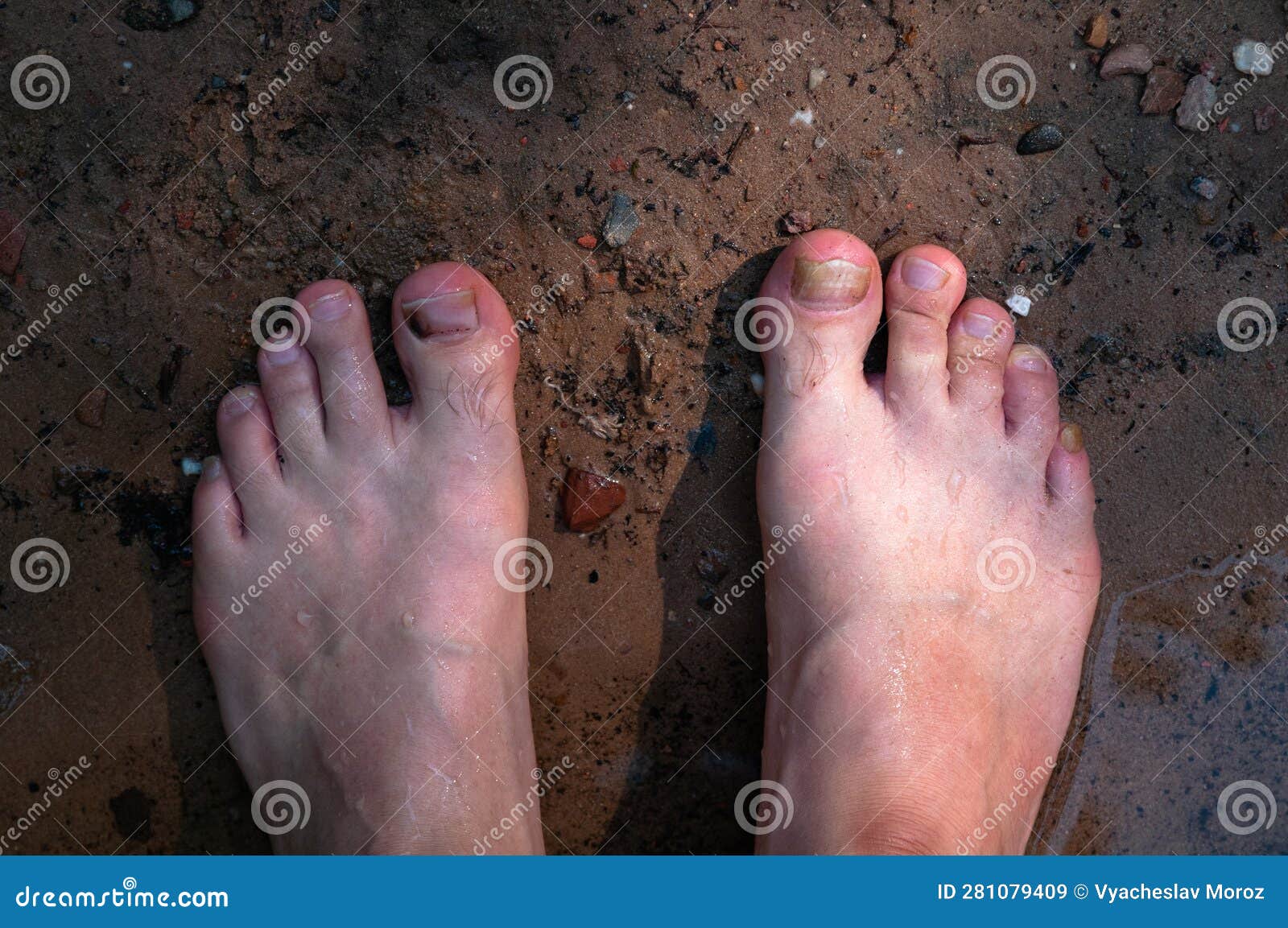 Close-up of the Feet of a Man Who is Standing on the Ground. Stock ...