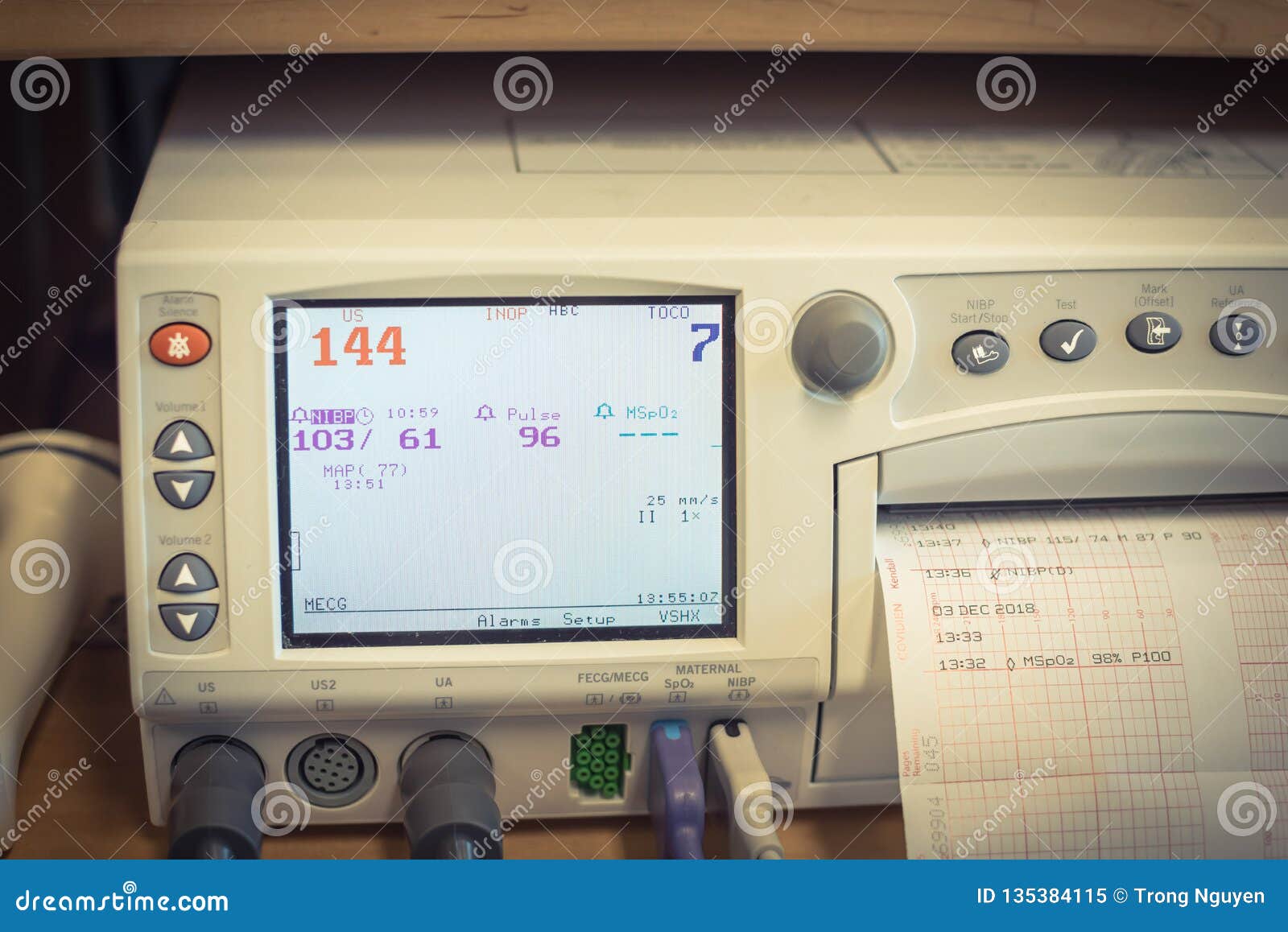 Contraction Chart In Hospital