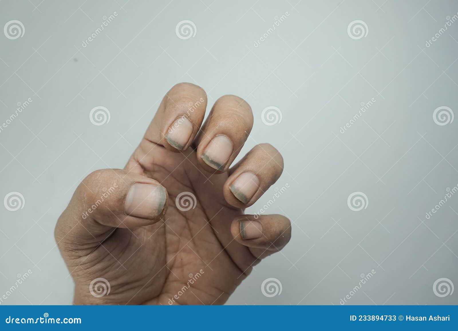 Closeup of Hands with Dirty Nails. Dirty Black Nails Stock Image