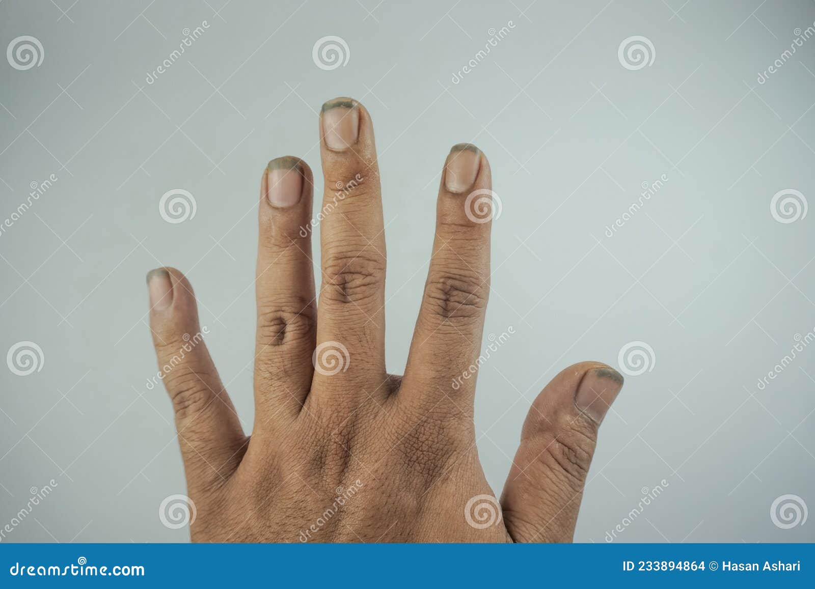 Closeup of Hands with Dirty Nails. Dirty Black Nails Stock Photo