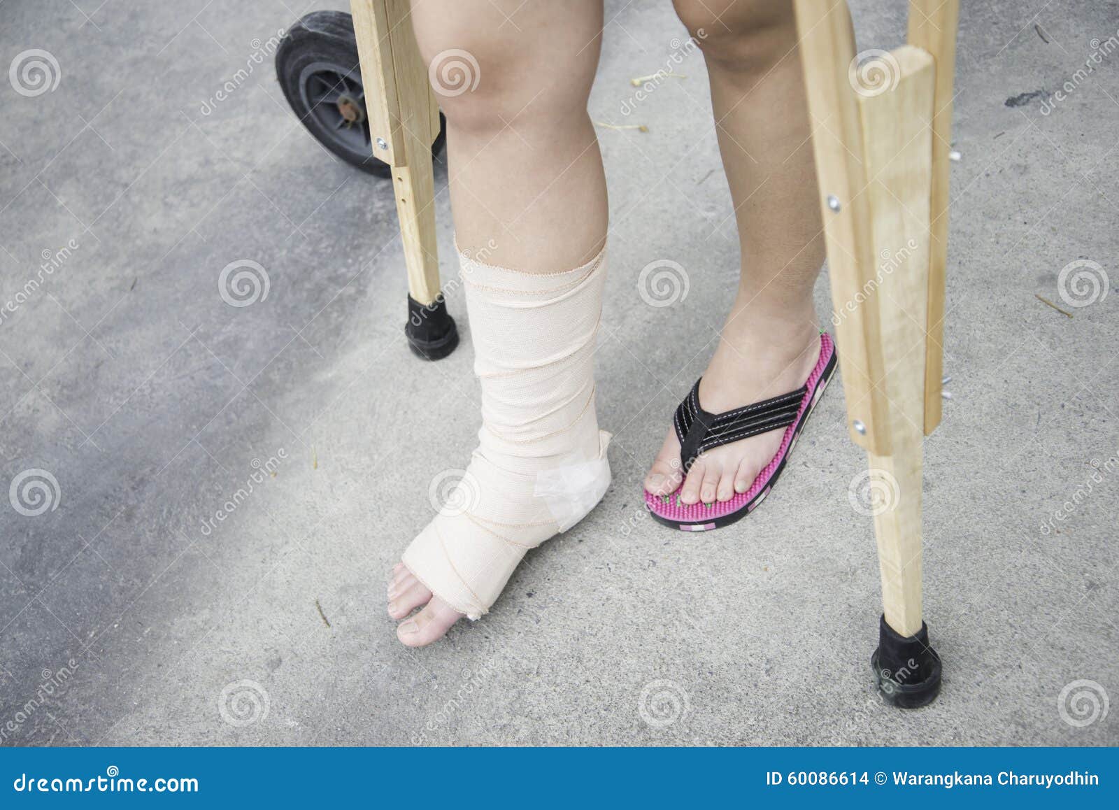 Close Up of Hands Holding Crutches Waking on the Street Stock Photo
