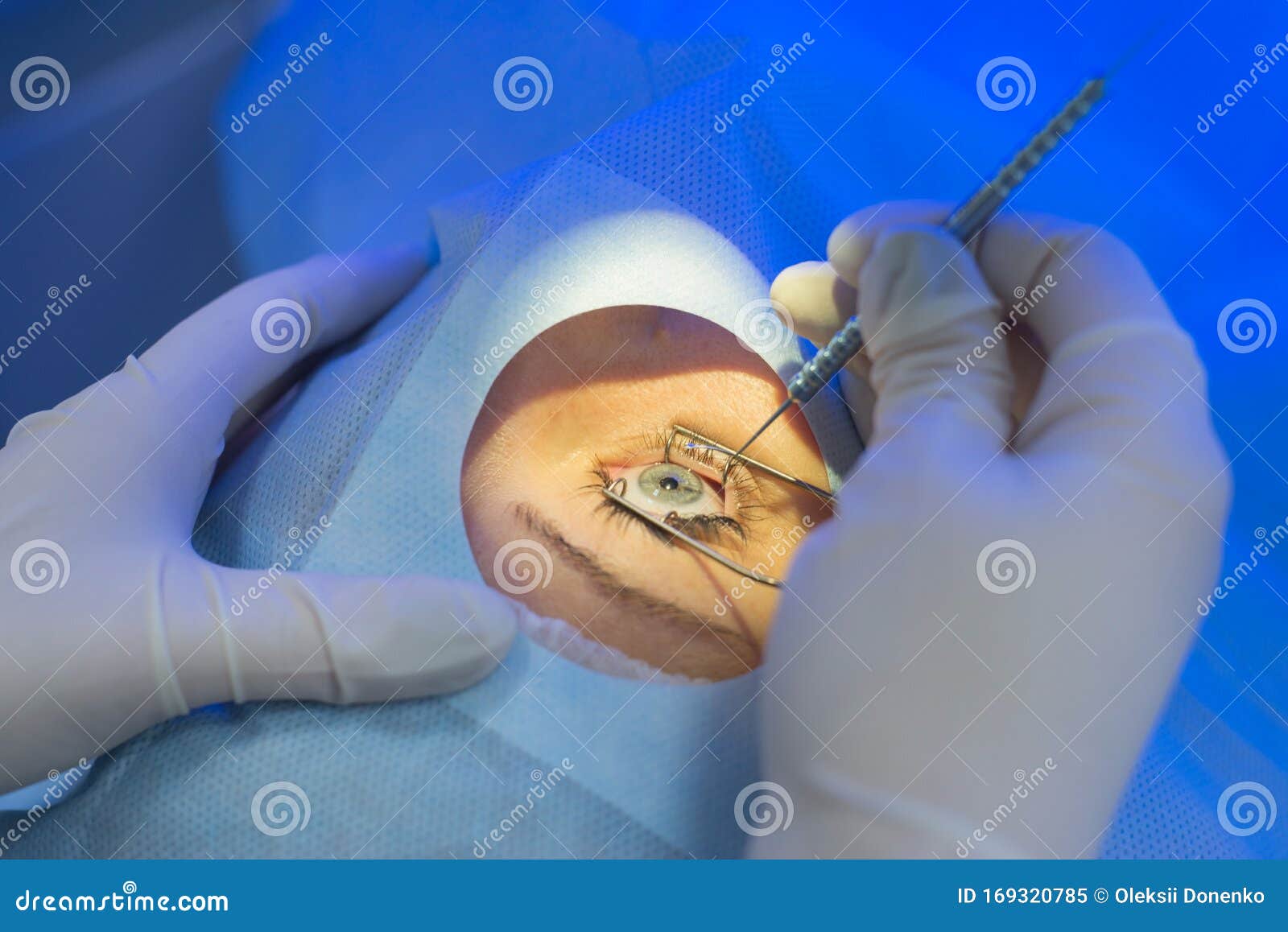 A Closeup of the Hands of an Ophthalmologist Surgeon Looking through a
