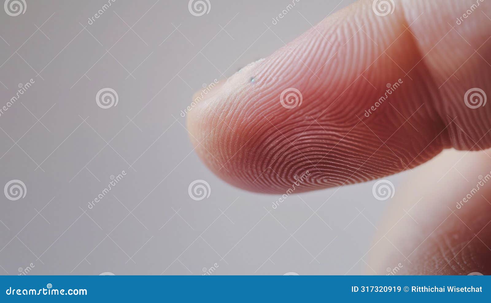close-up of a human fingertip showing detailed fingerprints and a tiny blue microchip implant