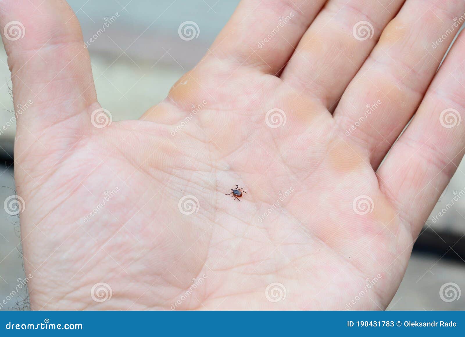 a close-up on ixodes scapularis, blacklegged tick or deer tick, transmitter of lyme and borrelia disease on a man`s palm