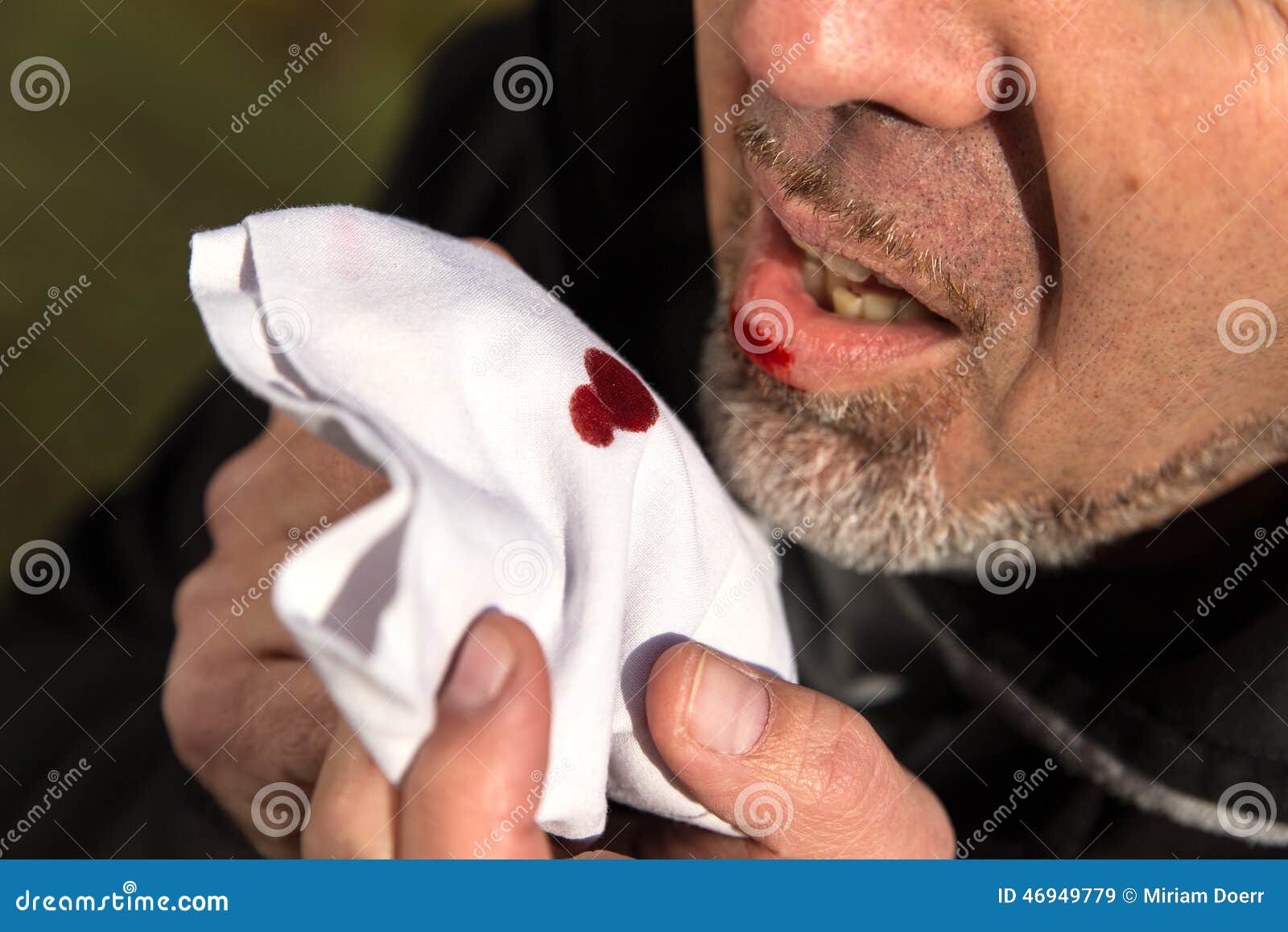 Ill Man With Bloody Cough. Male Tuberculosis Problem. Lung Cancer