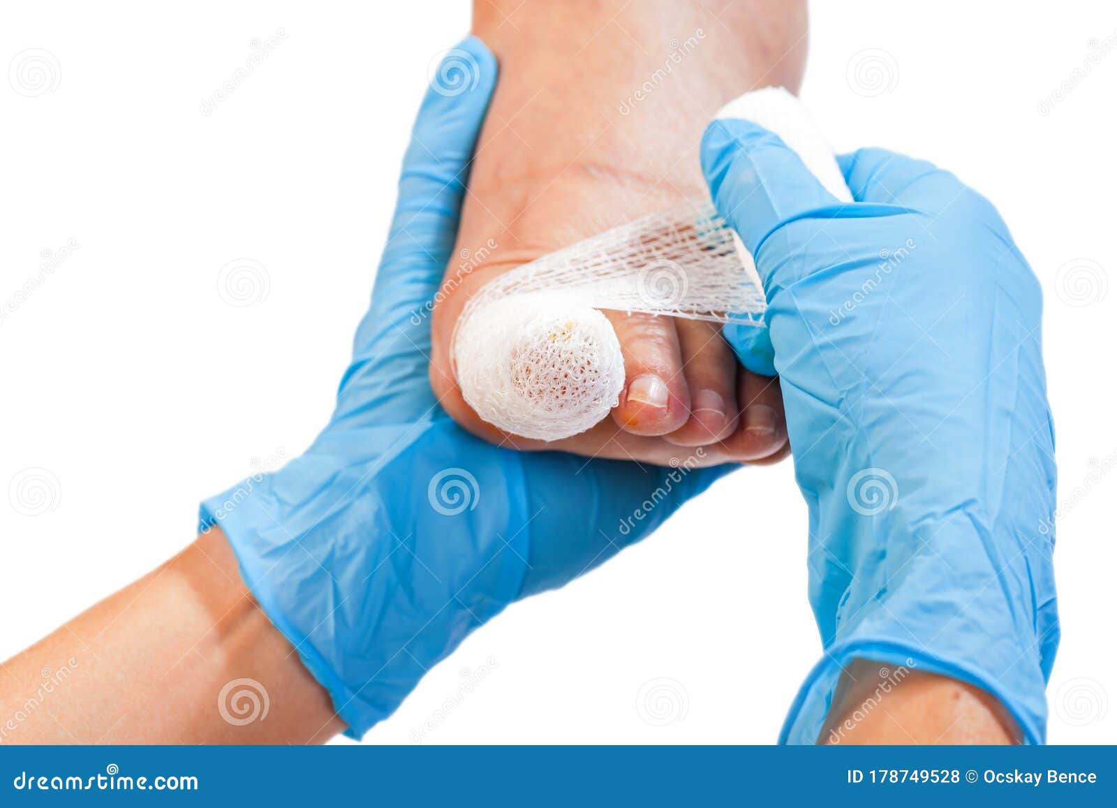 injured black toe nail design
