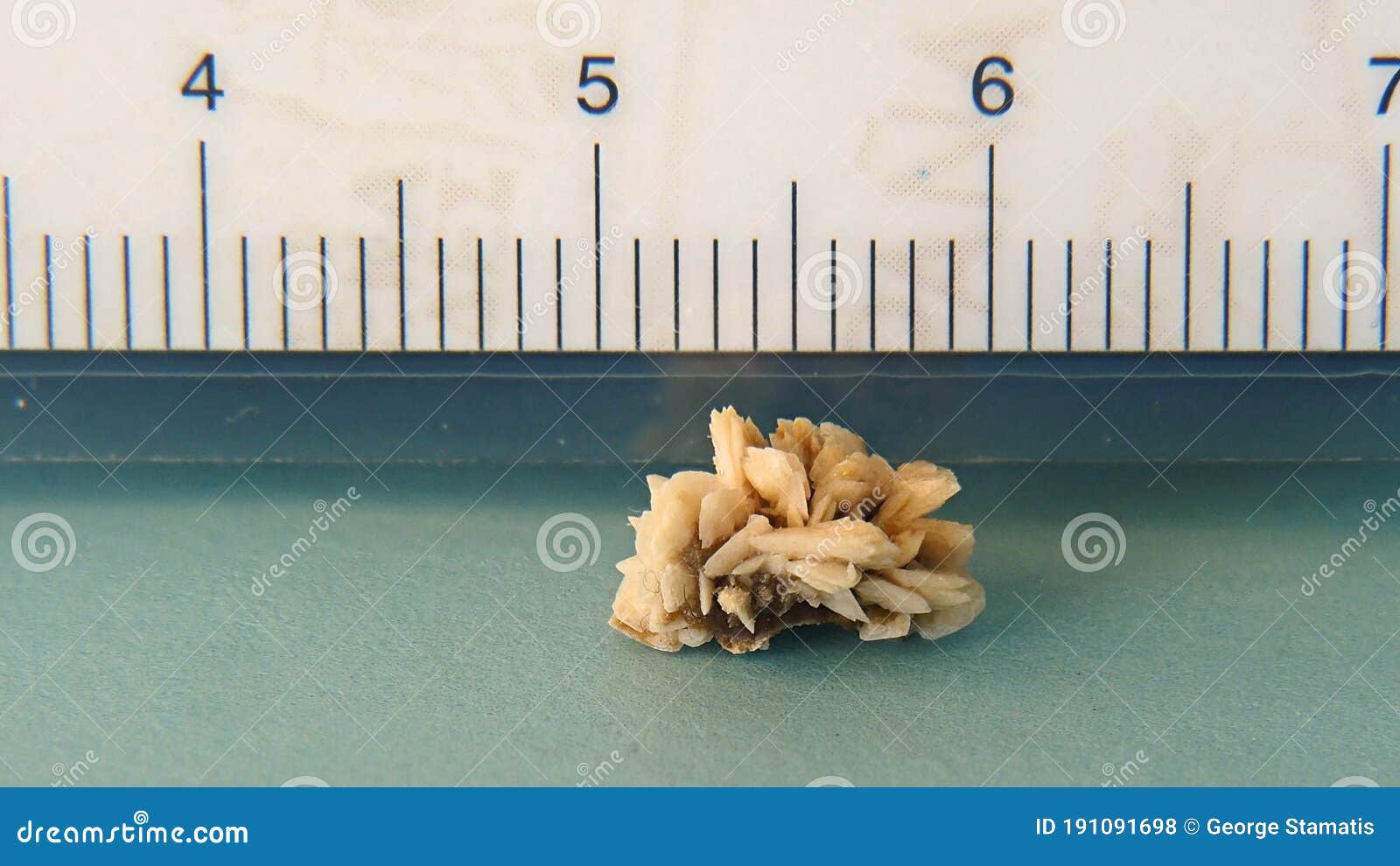 Kidney Stone Chart