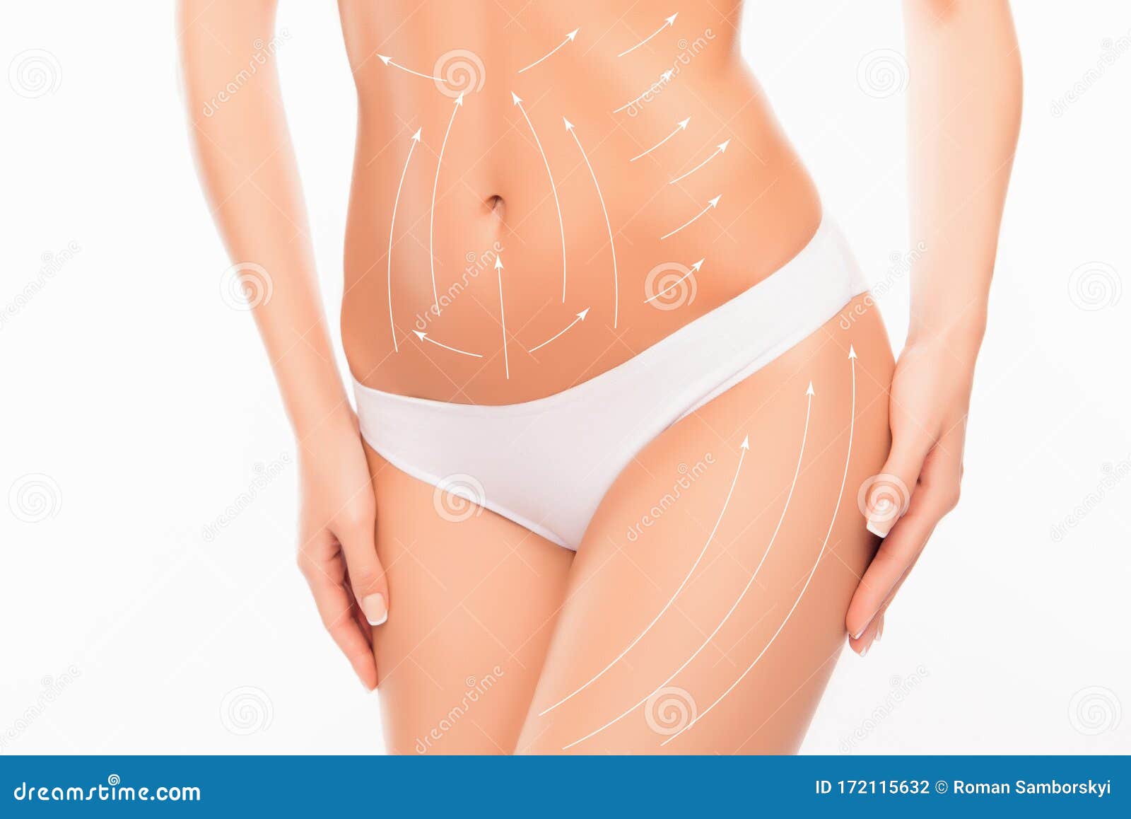 Close up photo of woman`s belly and hip with drawing arrows on it.