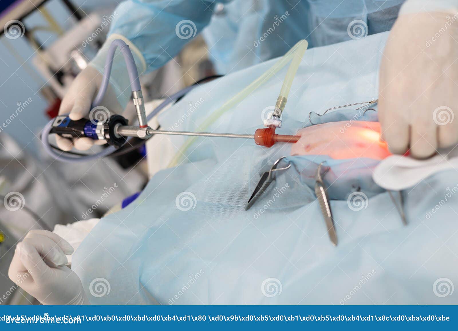 Closeup Plan for Placing an Endoscopic Instrument during Surgery on an
