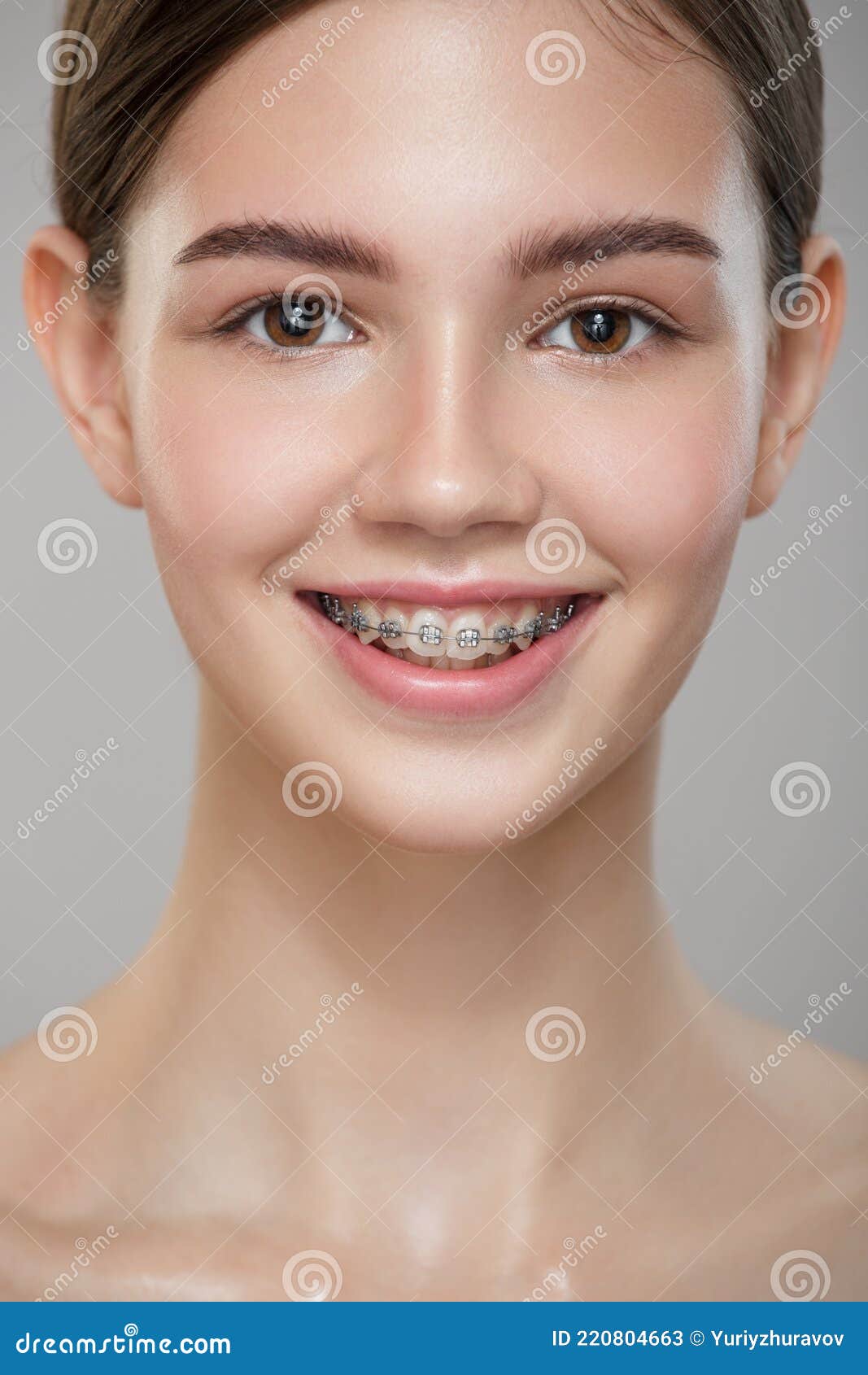 Close-up Portrait Cute Smiling Girl in Braces. Stock Image - Image of ...