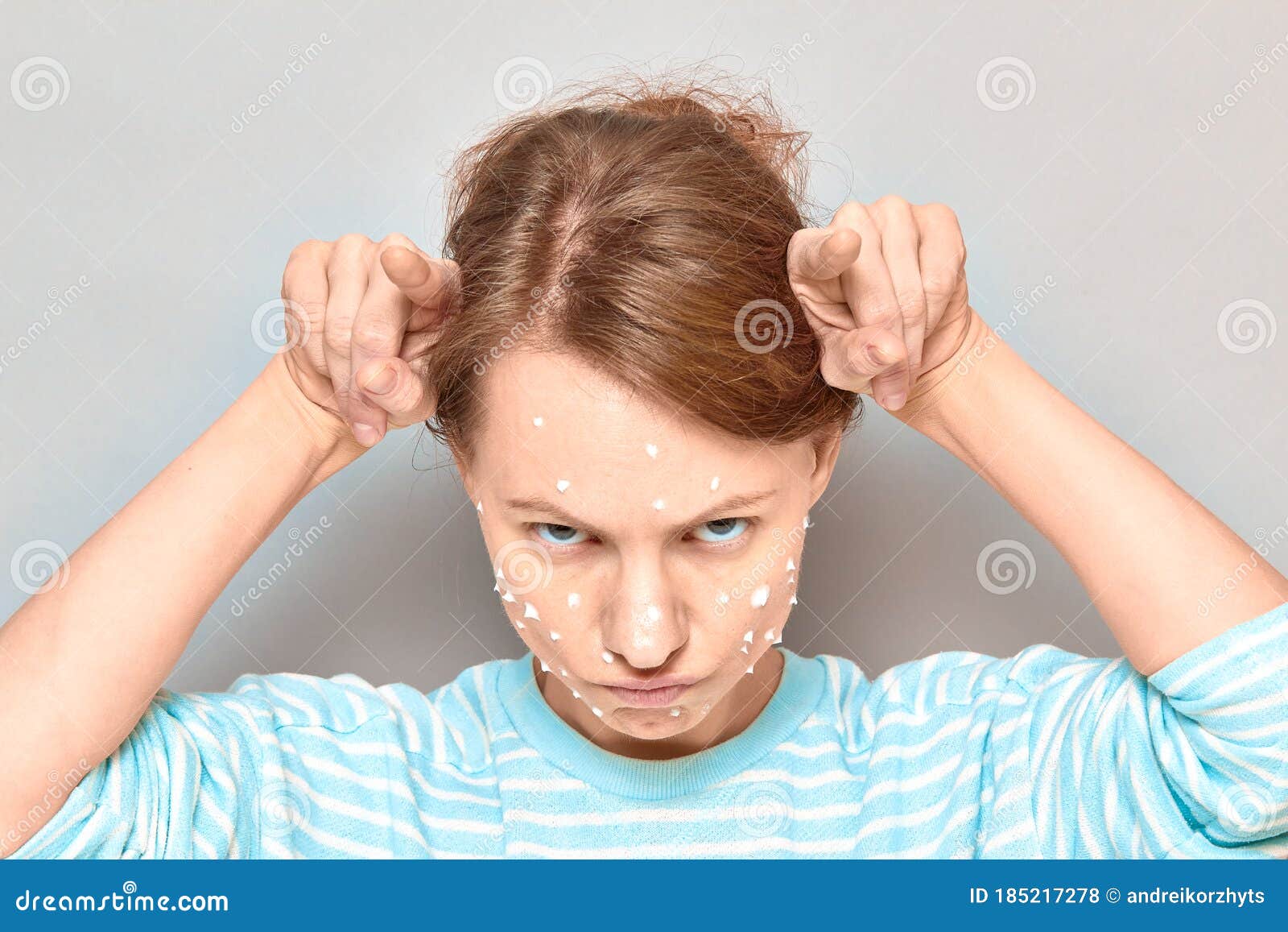 Portrait of Funny Angry Girl with White Drops of Face Cream on Skin Stock Photo - Image of dissatisfied, adult: 185217278 Portrait of Funny Angry Girl with White Drops of Face Cream on Skin Stock Photo - Image of dissatisfied, adult: 185217278