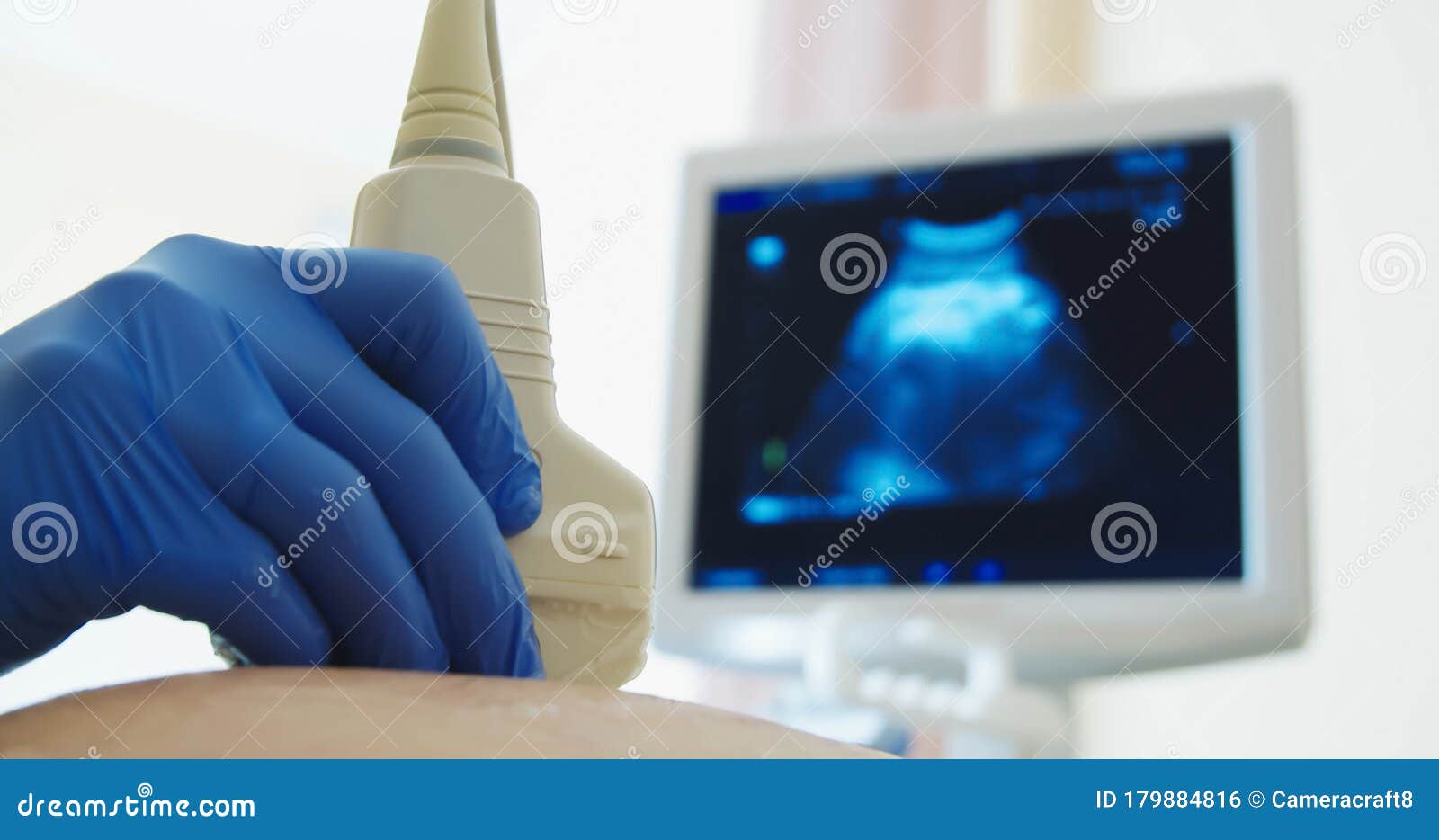 close up of a pregnant woman having ultrasound scanning at the medical clinic. ultrasound monitor in the background