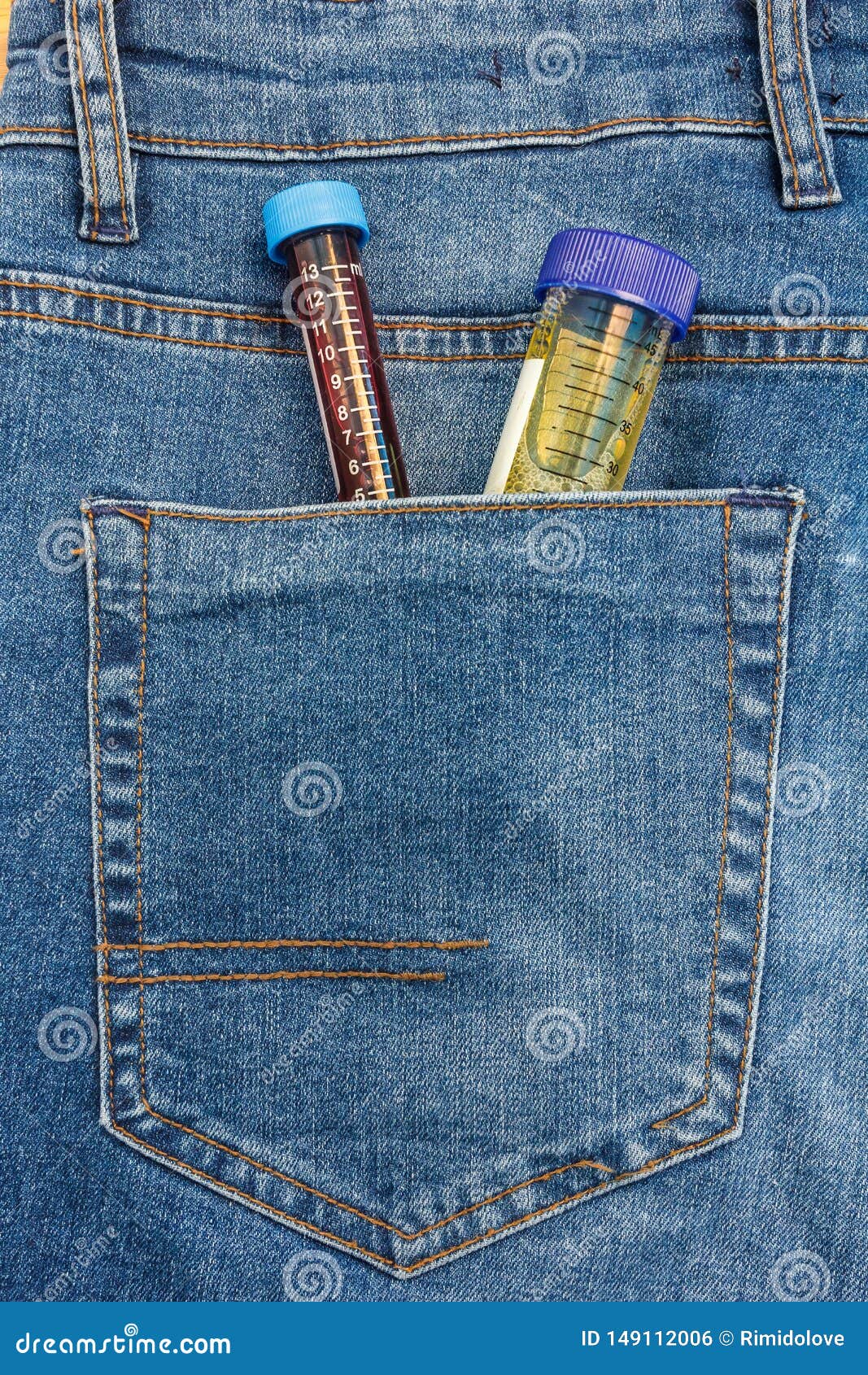 Close Up View To Test Tube with Urine and Blood Sticking Out from