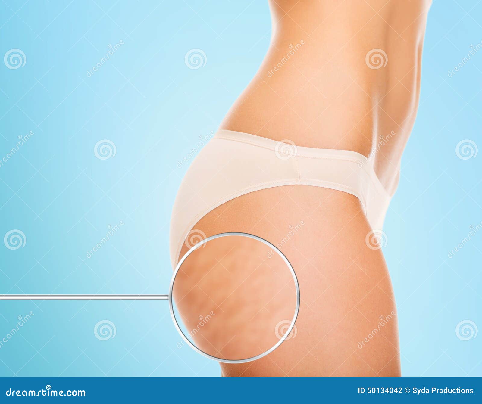 Close Up of Woman Buttocks with Cellulite Stock Photo - Image of