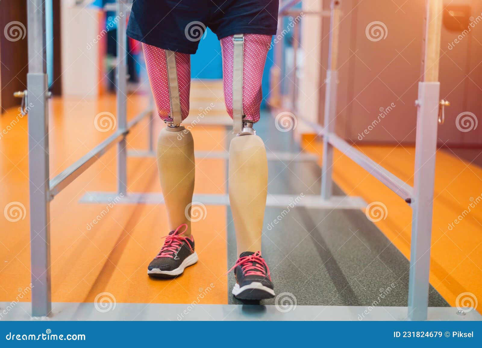 Woman with Prosthetic Legs Using Parallel Bars Stock Image Image of