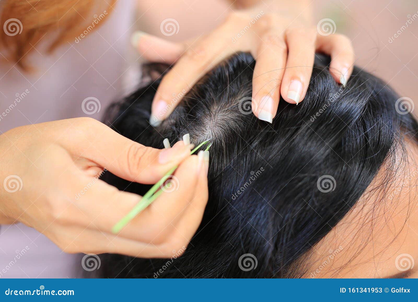 Close Up Woman`s Hand Using Tweezers To Plucking Gray Hair Roots from Head  Stock Image - Image of female, graying: 161341953